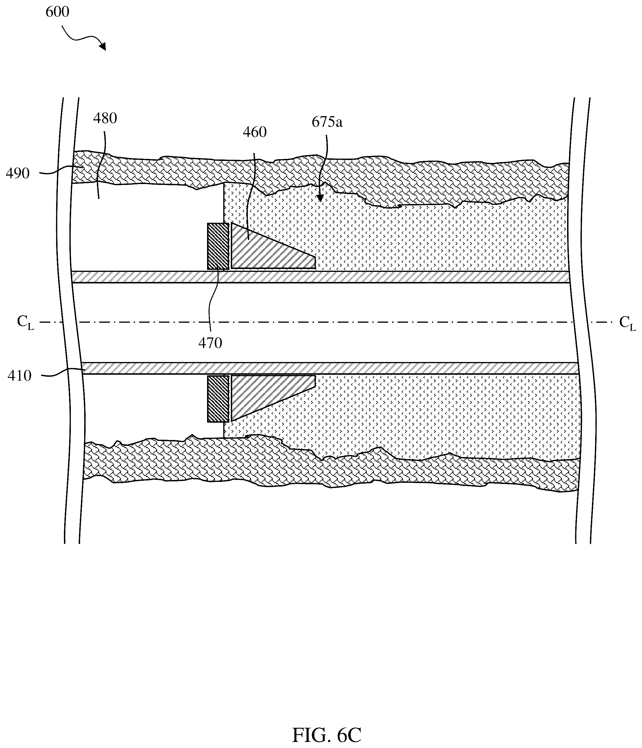 Patent US12305459 Figure 19 – Sealing/anchoring tool employing an expandable metal circlet