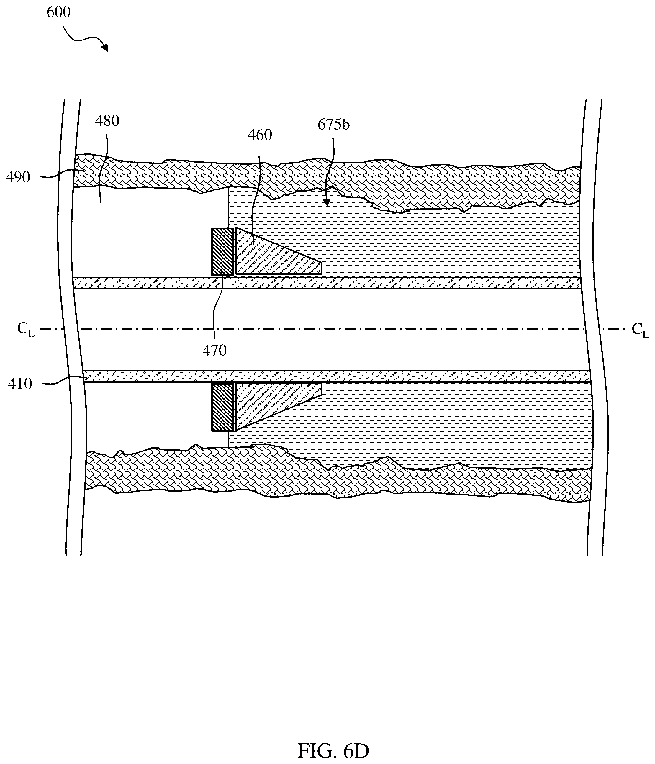 Patent US12305459 Figure 20 – Sealing/anchoring tool employing an expandable metal circlet