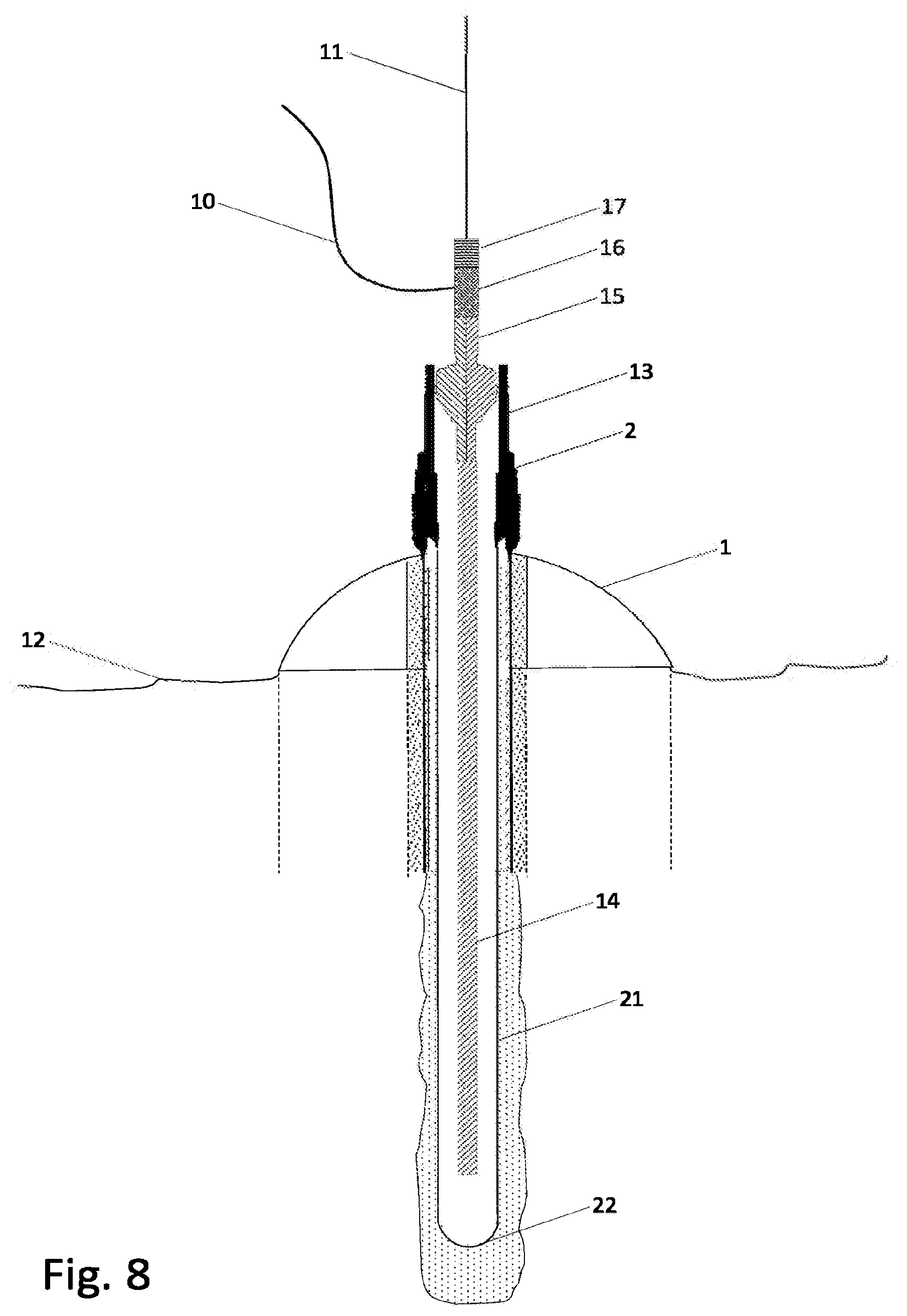 Patent US12305513 Figure 10 – Rigless drilling and wellhead installation
