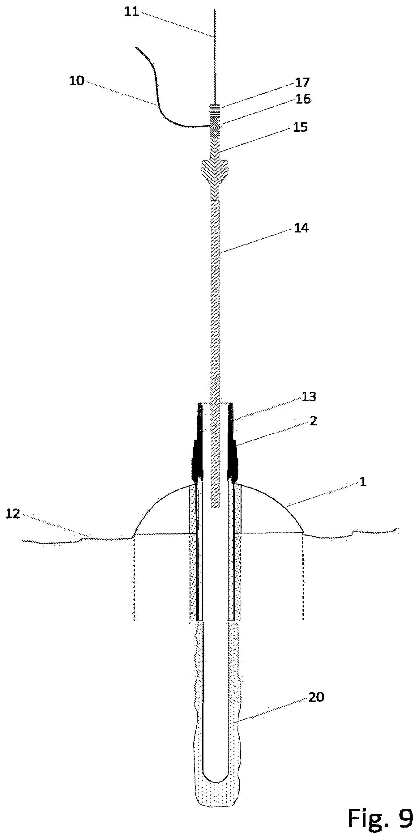 Patent US12305513 Figure 11 – Rigless drilling and wellhead installation