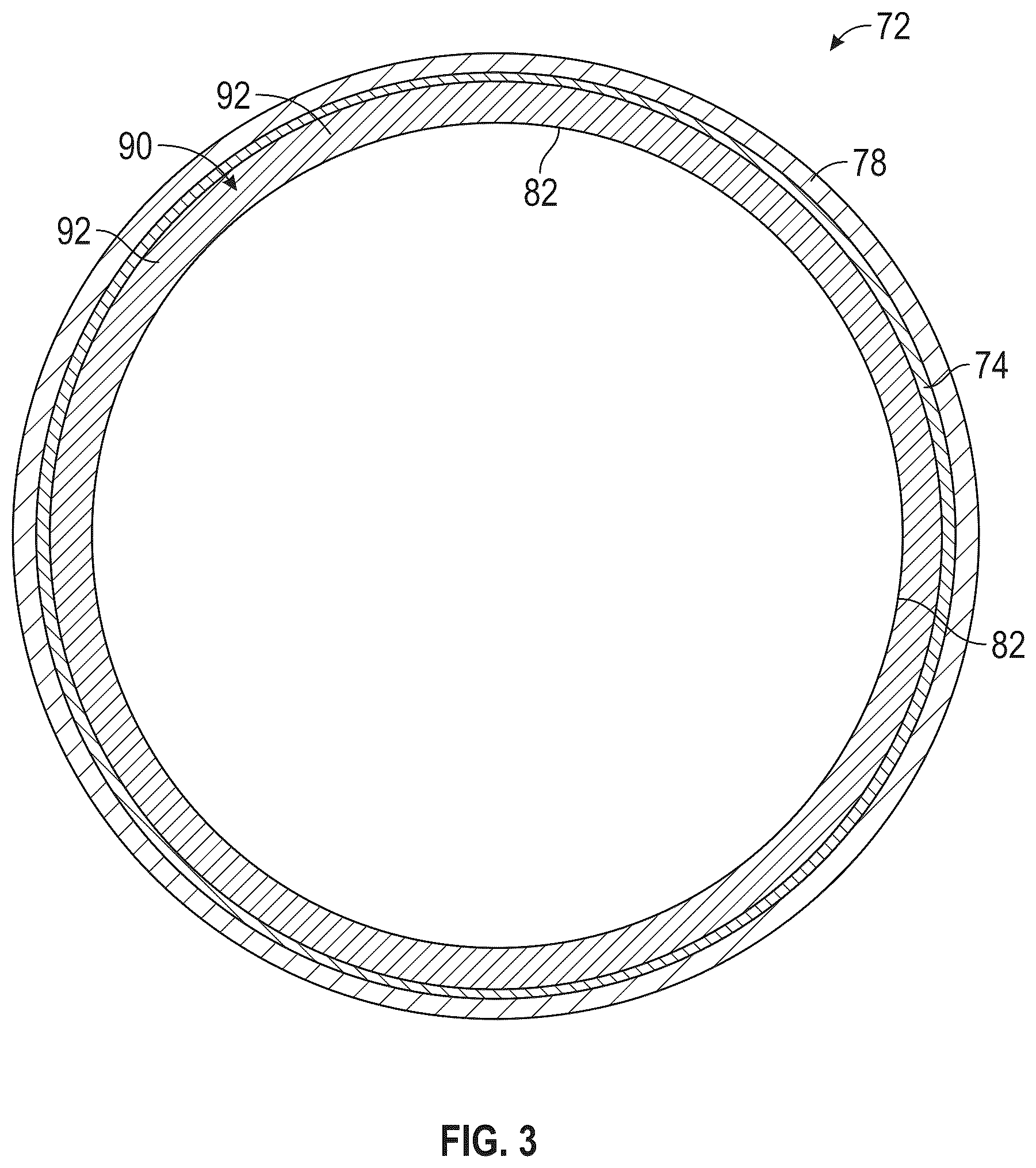 Patent US12305524 Figure 3 – Containment ring for gas turbine engine