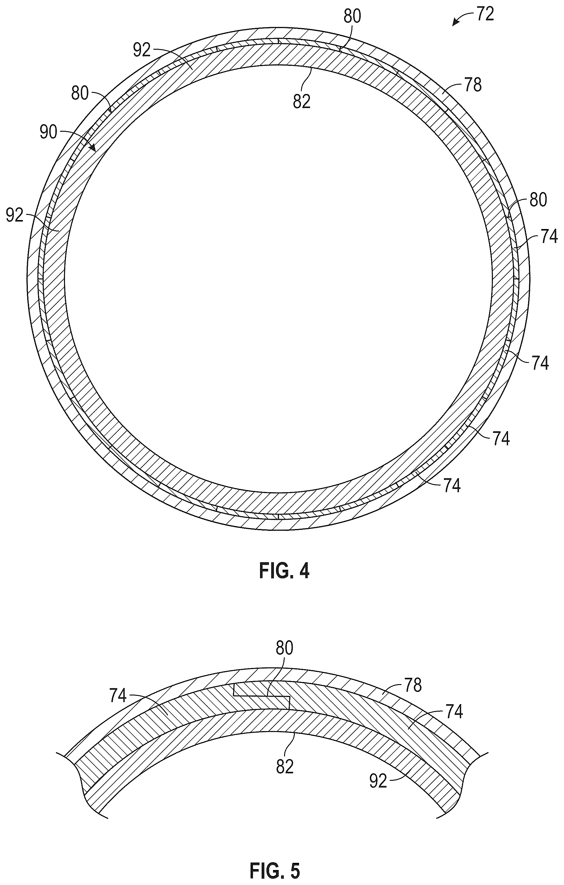 Patent US12305524 Figure 4 – Containment ring for gas turbine engine