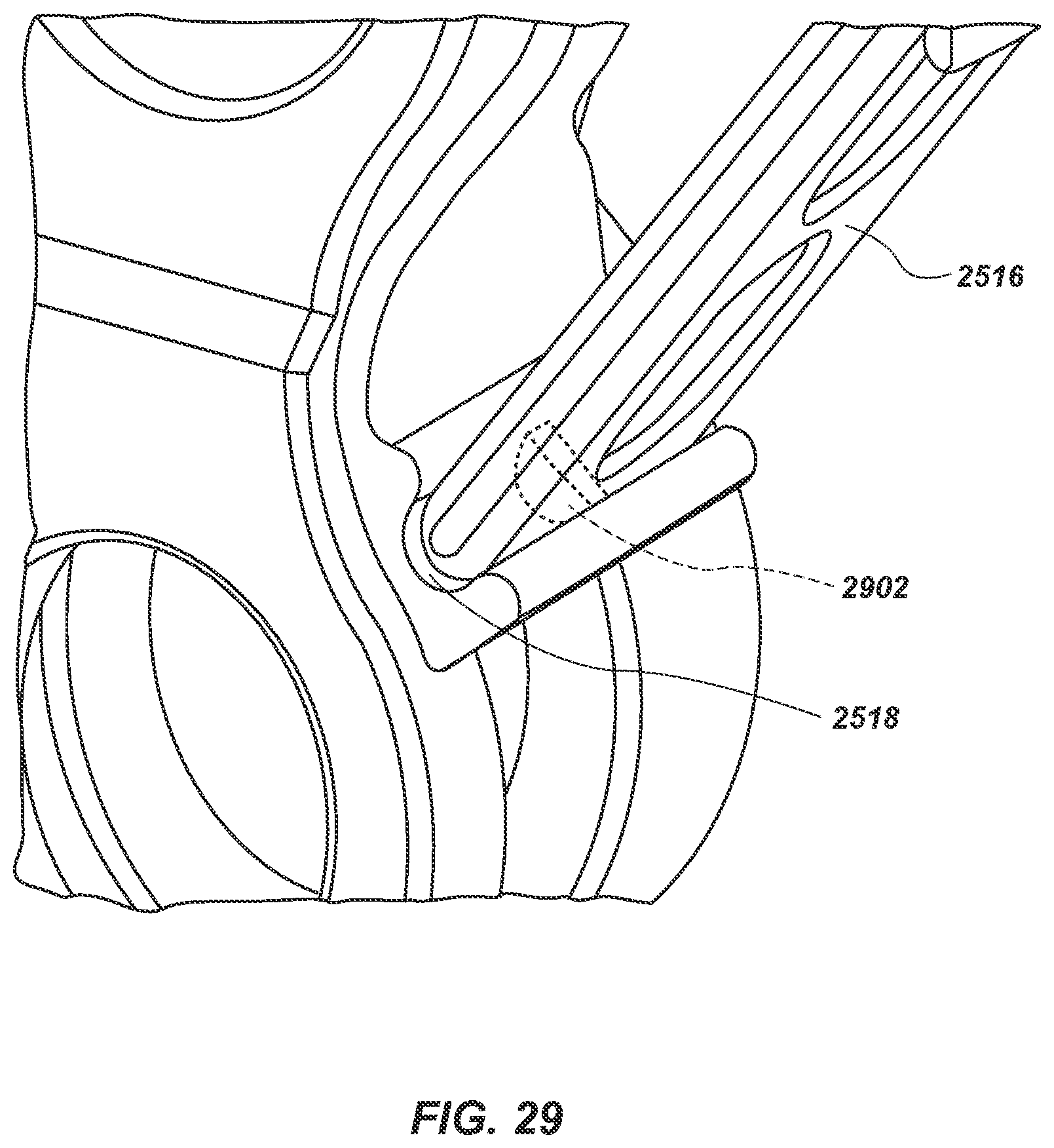 Patent US12305591 Figure 20 – Reciprocating-piston assembly, internal combustion engine, and related methods