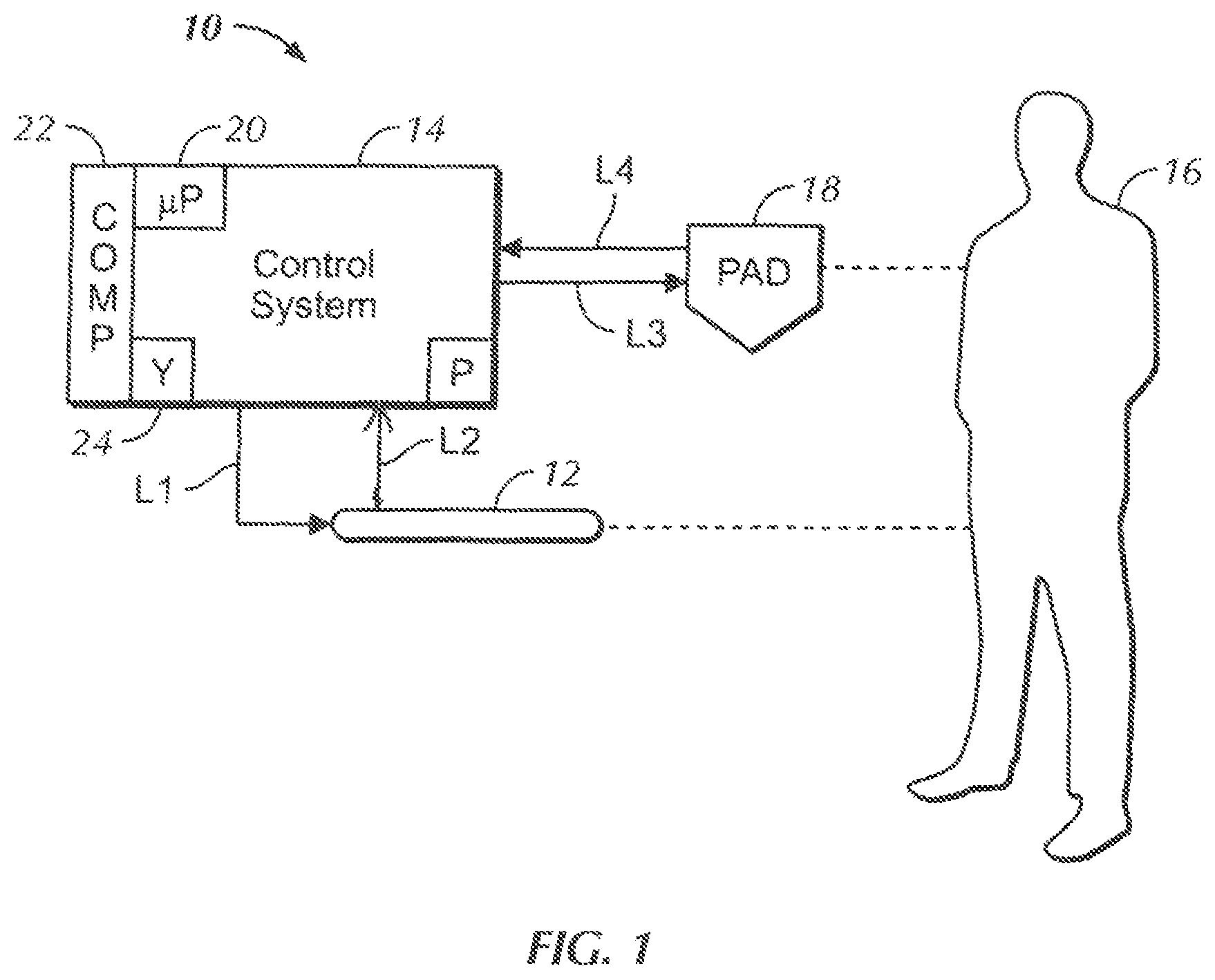 Patent US12305631 Figure 1 – Heat exchange system for patient temperature control with easy loading high performance peristaltic pump