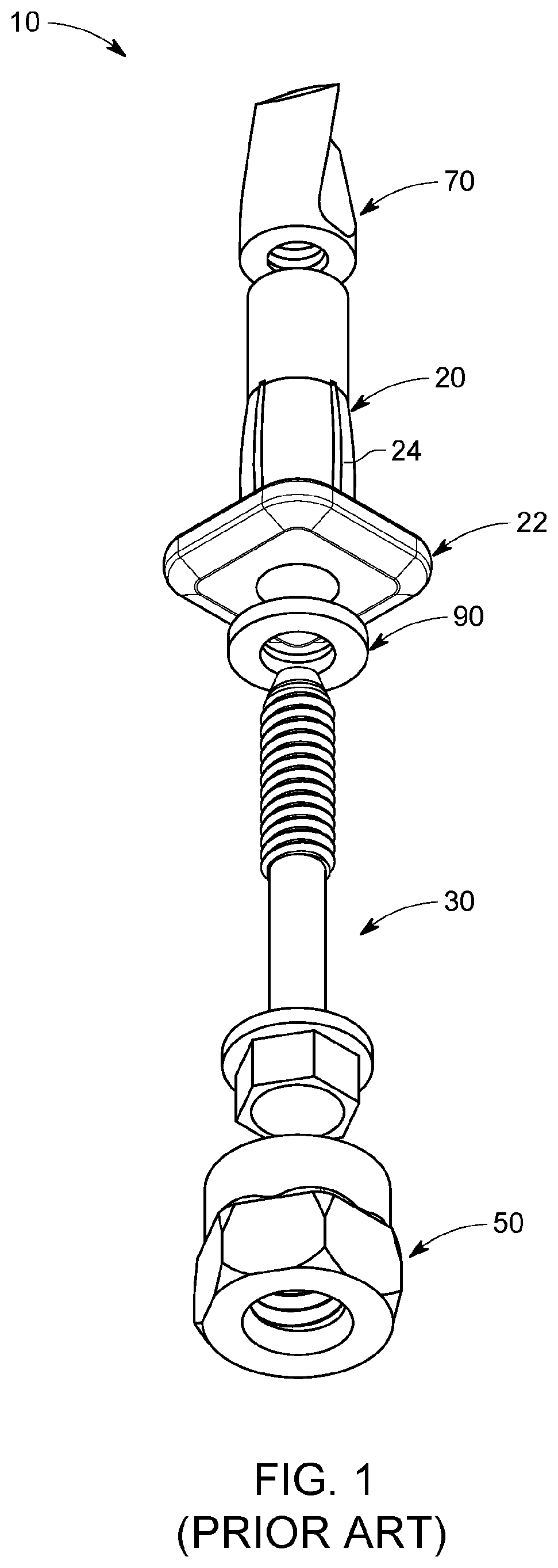Patent US12305678 Figure 1 – Expandable anchor installation tool and methods of use thereof