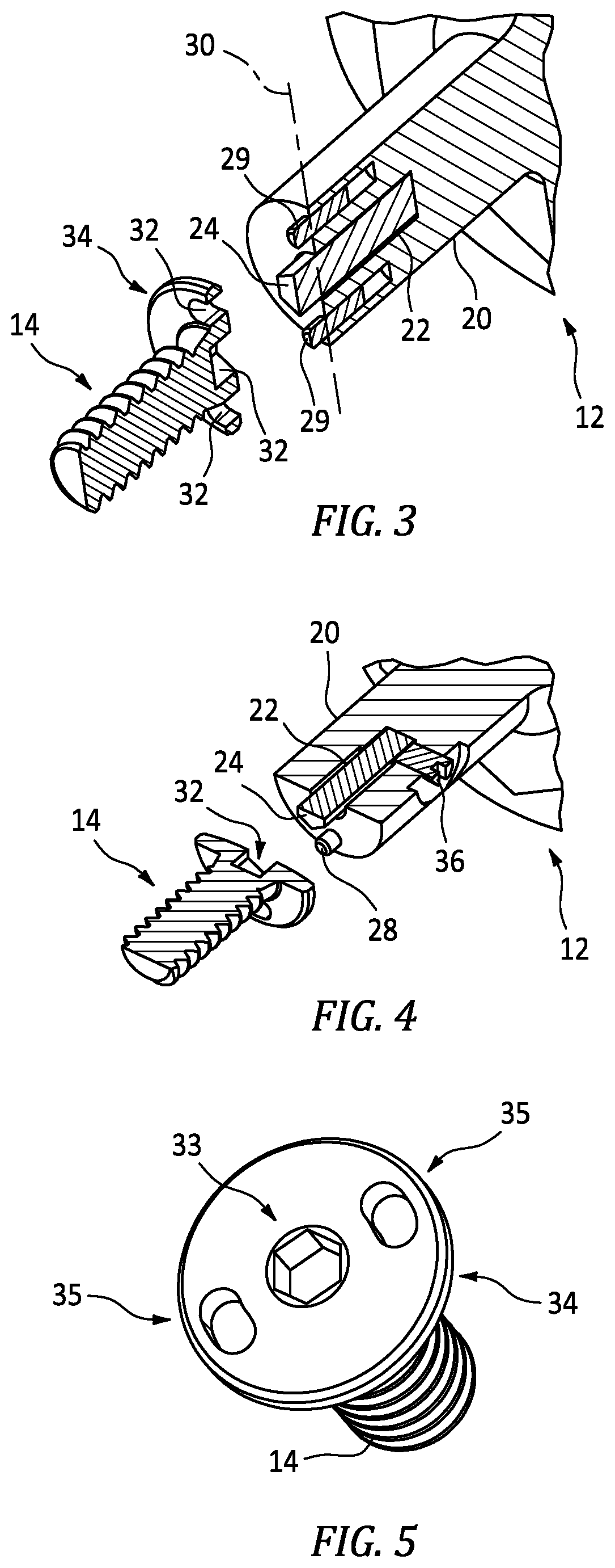 Patent US12305684 Figure 2 – Sequential torque application retention system