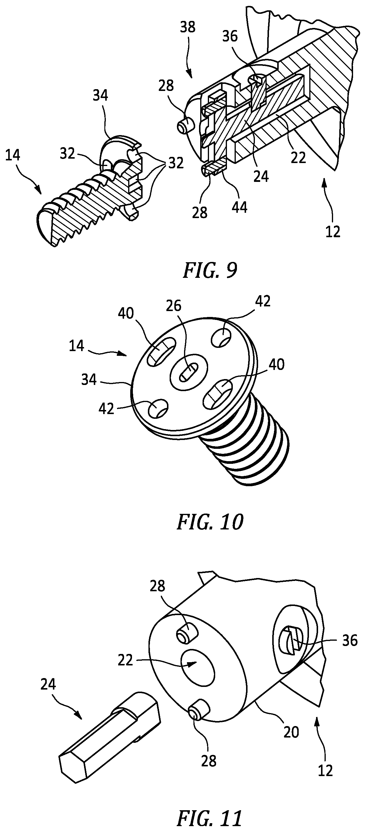 Patent US12305684 Figure 4 – Sequential torque application retention system