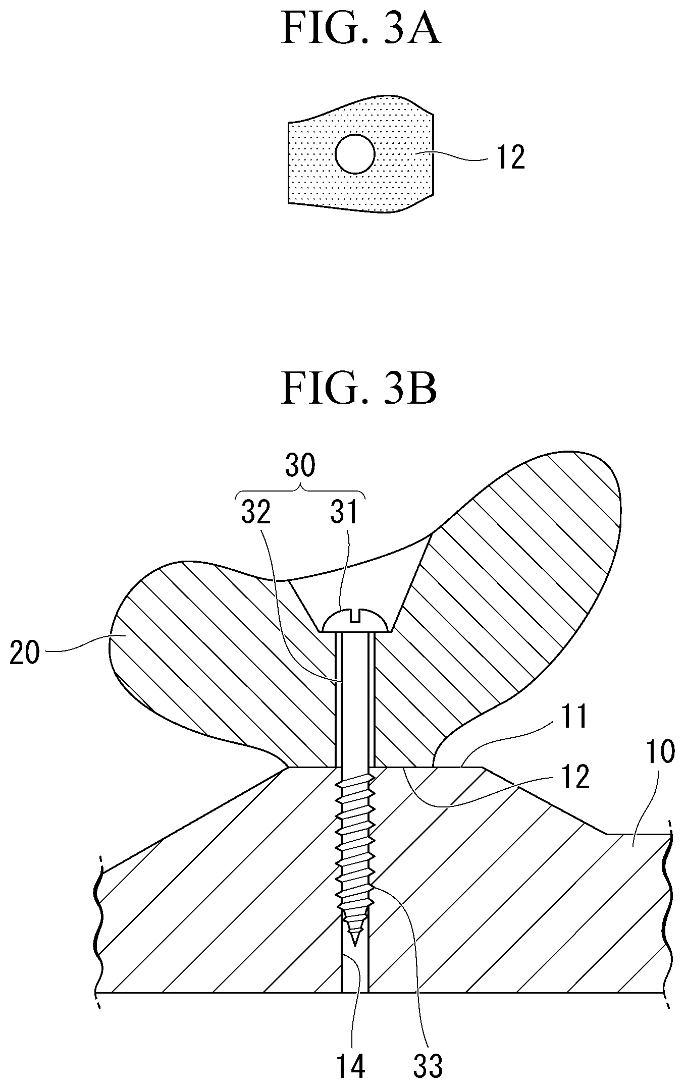 Patent US12305685 Figure 2 – Fastening structure and keyboard device
