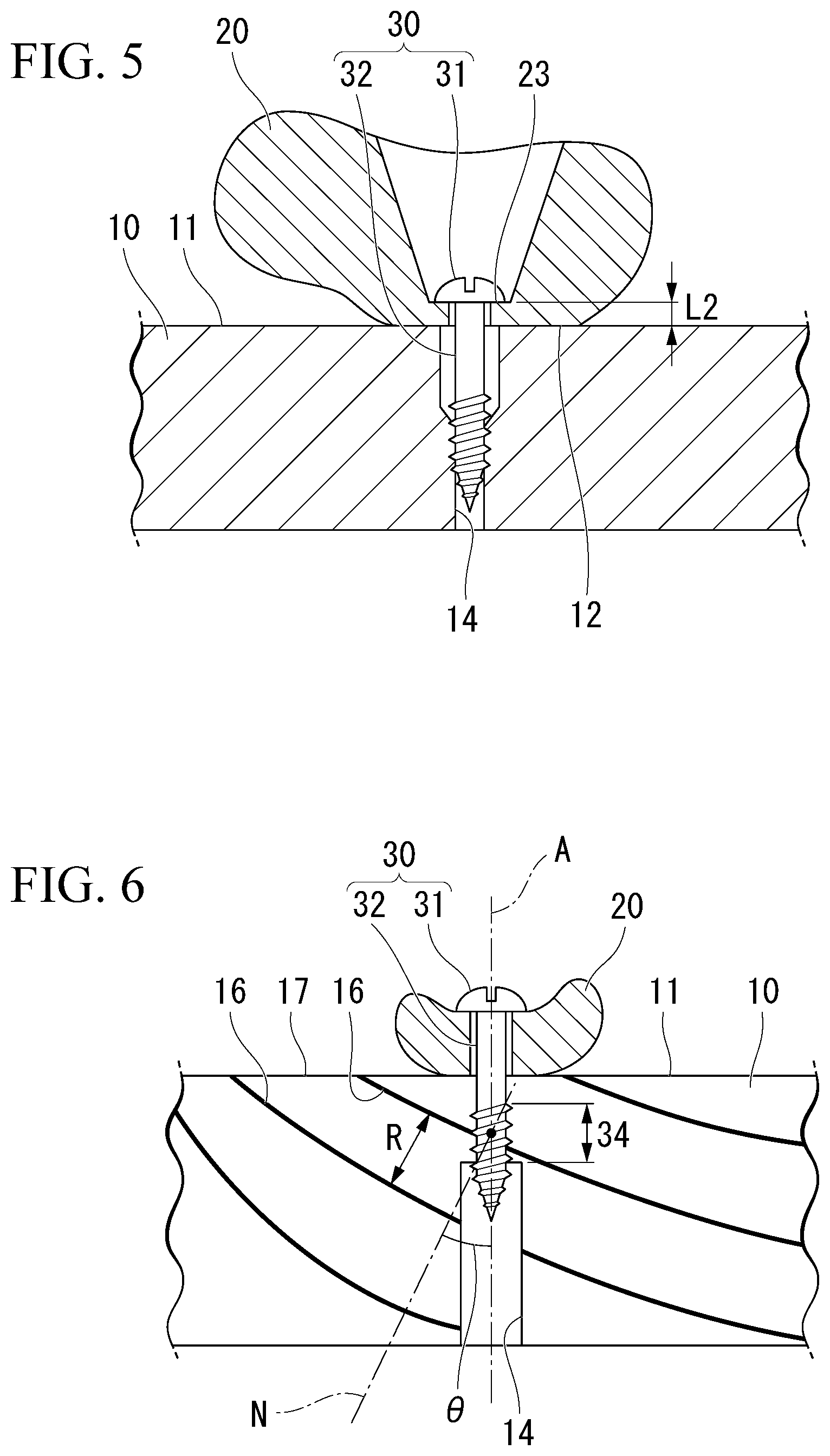 Patent US12305685 Figure 4 – Fastening structure and keyboard device