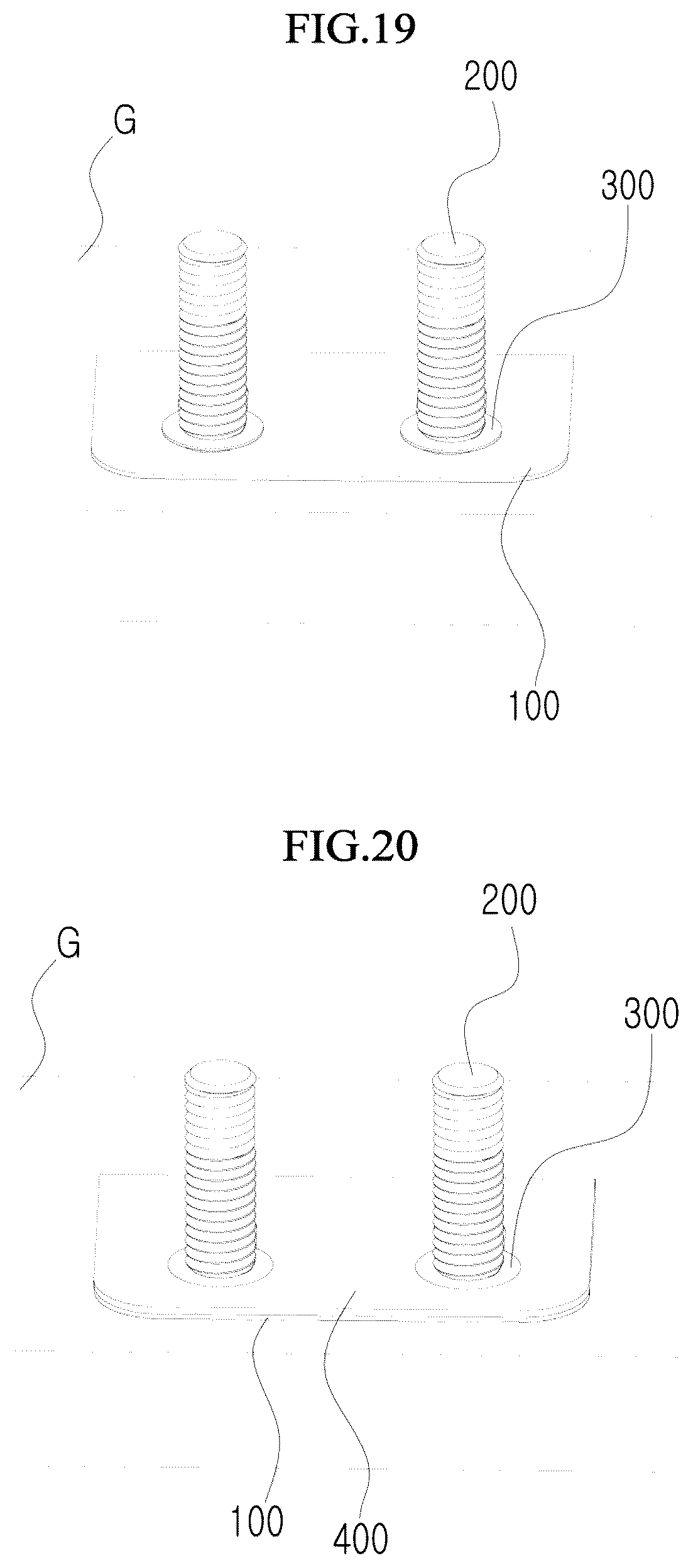 Patent US12305687 Figure 11 – L-shaped bolt fastening structure using hole guard