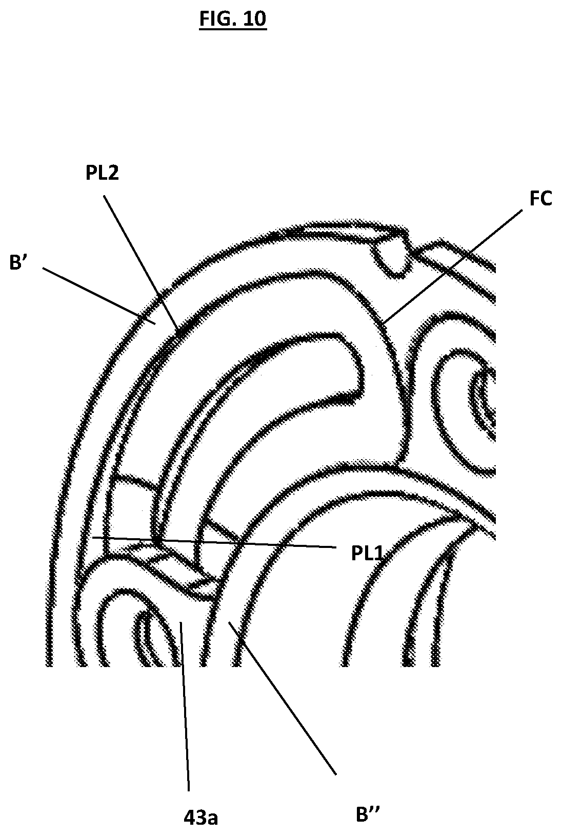 Patent US12305693 Figure 11 – Pressure fixing device of panel-works, in particular covering panels in the nautical field