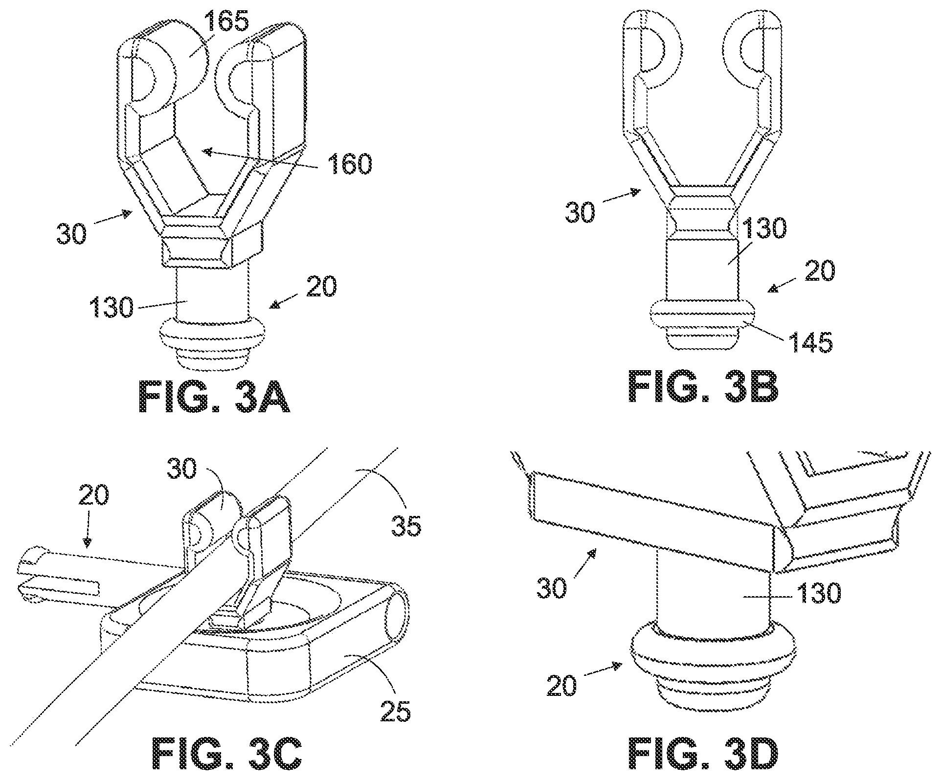 Patent US12305784 Figure 16 – Systems and methods for providing a tube and cord organization system
