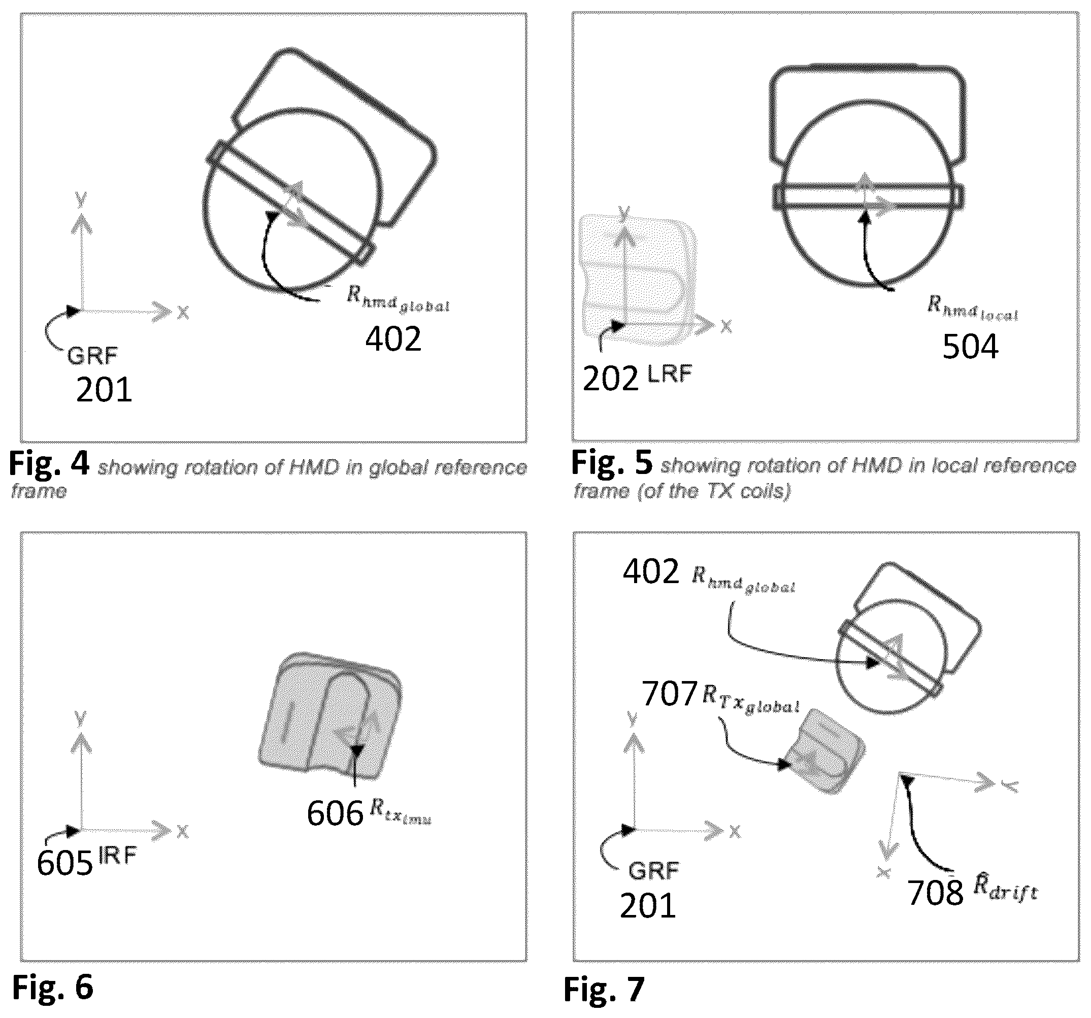 Patent US12305990 Figure 4 – Orienting a moving electromagnetic tracking reference frame via external localizing data on an electromagnetic sensor using IMU data