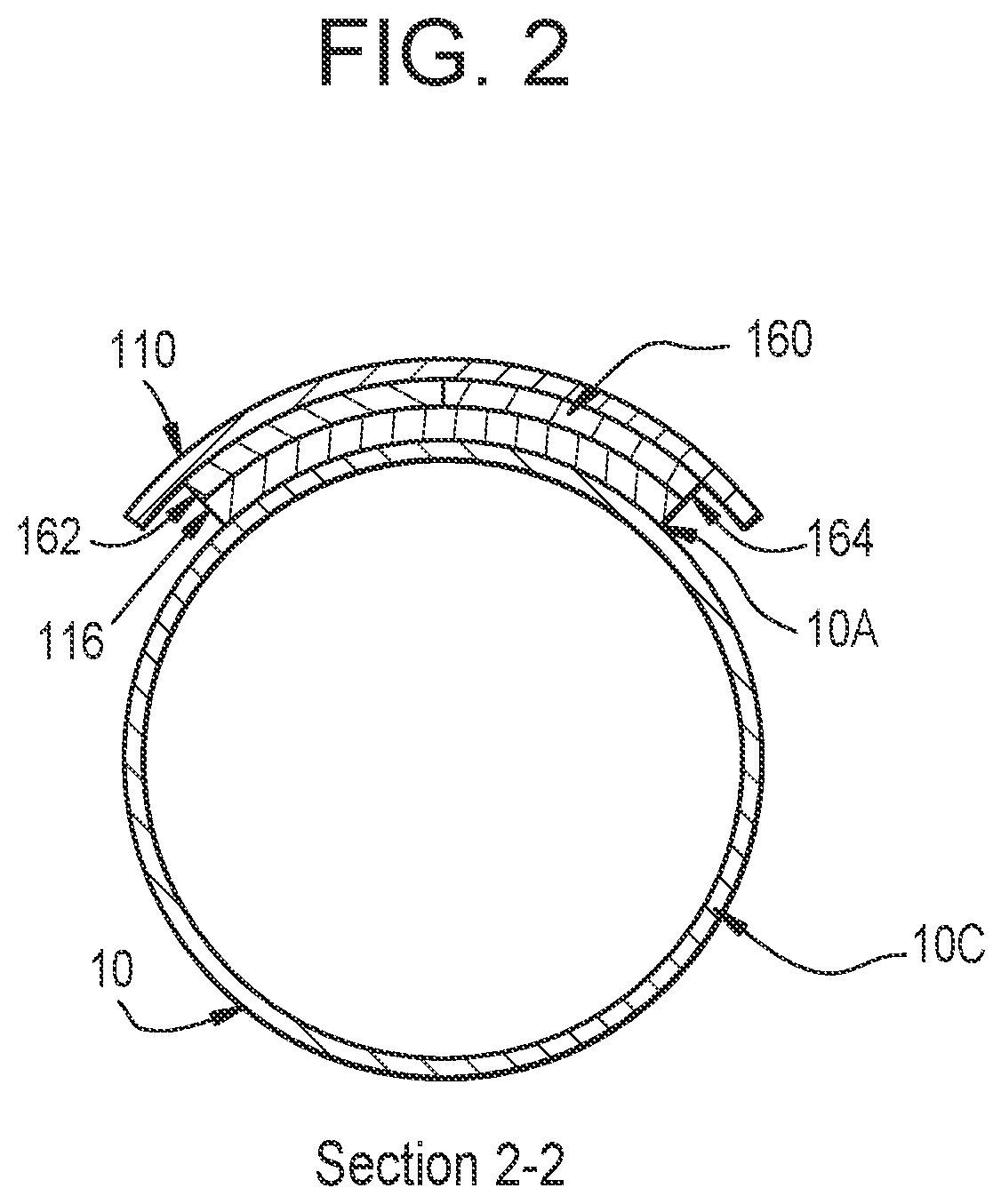 Patent US12306048 Figure 2 – Non-invasive measurement and calculation system