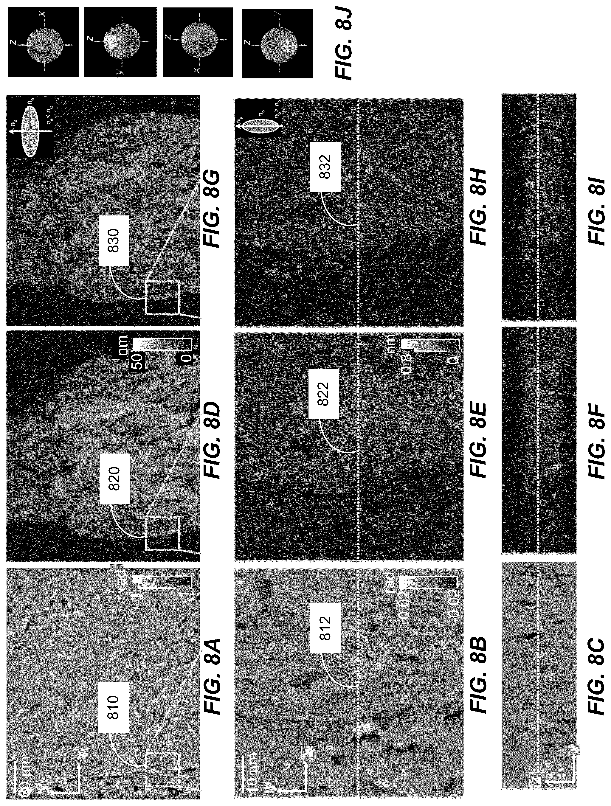 Patent US12306102 Figure 11 – Method and system for quantitative three dimensional measurement of density, anisotropy, and orientation without label