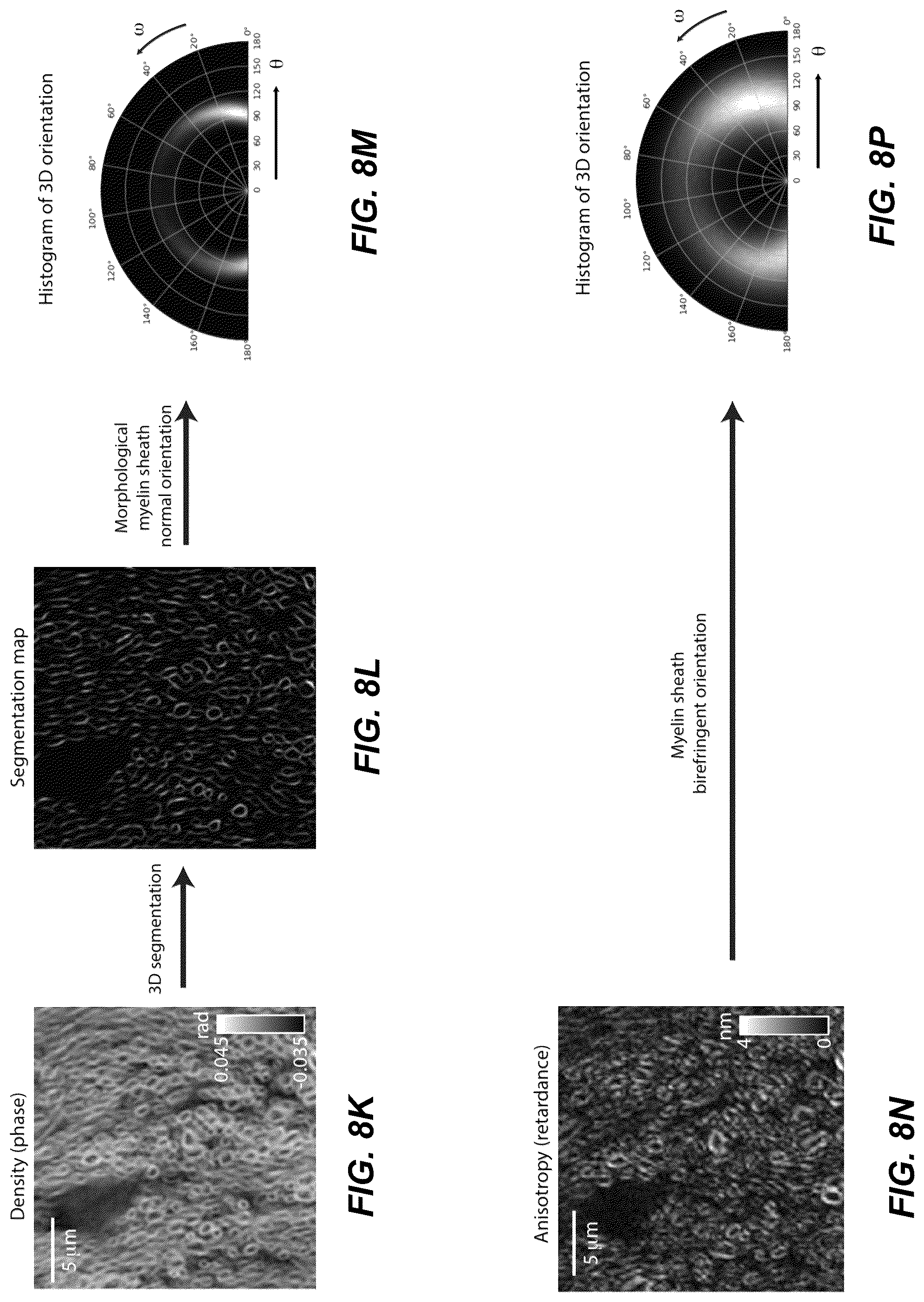 Patent US12306102 Figure 12 – Method and system for quantitative three dimensional measurement of density, anisotropy, and orientation without label