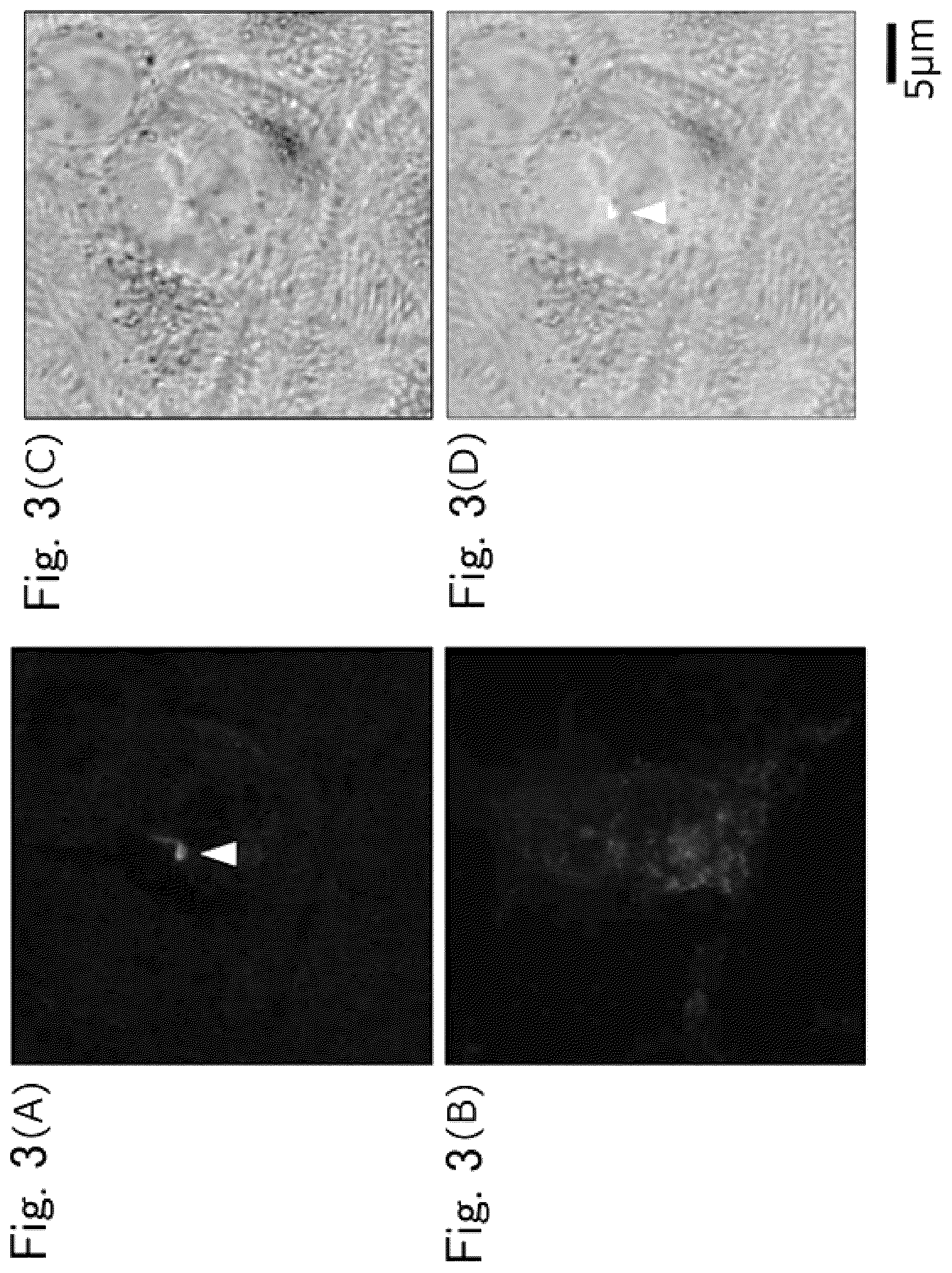 Patent US12306171 Figure 3 – Method for detecting indicator of immune-related disease