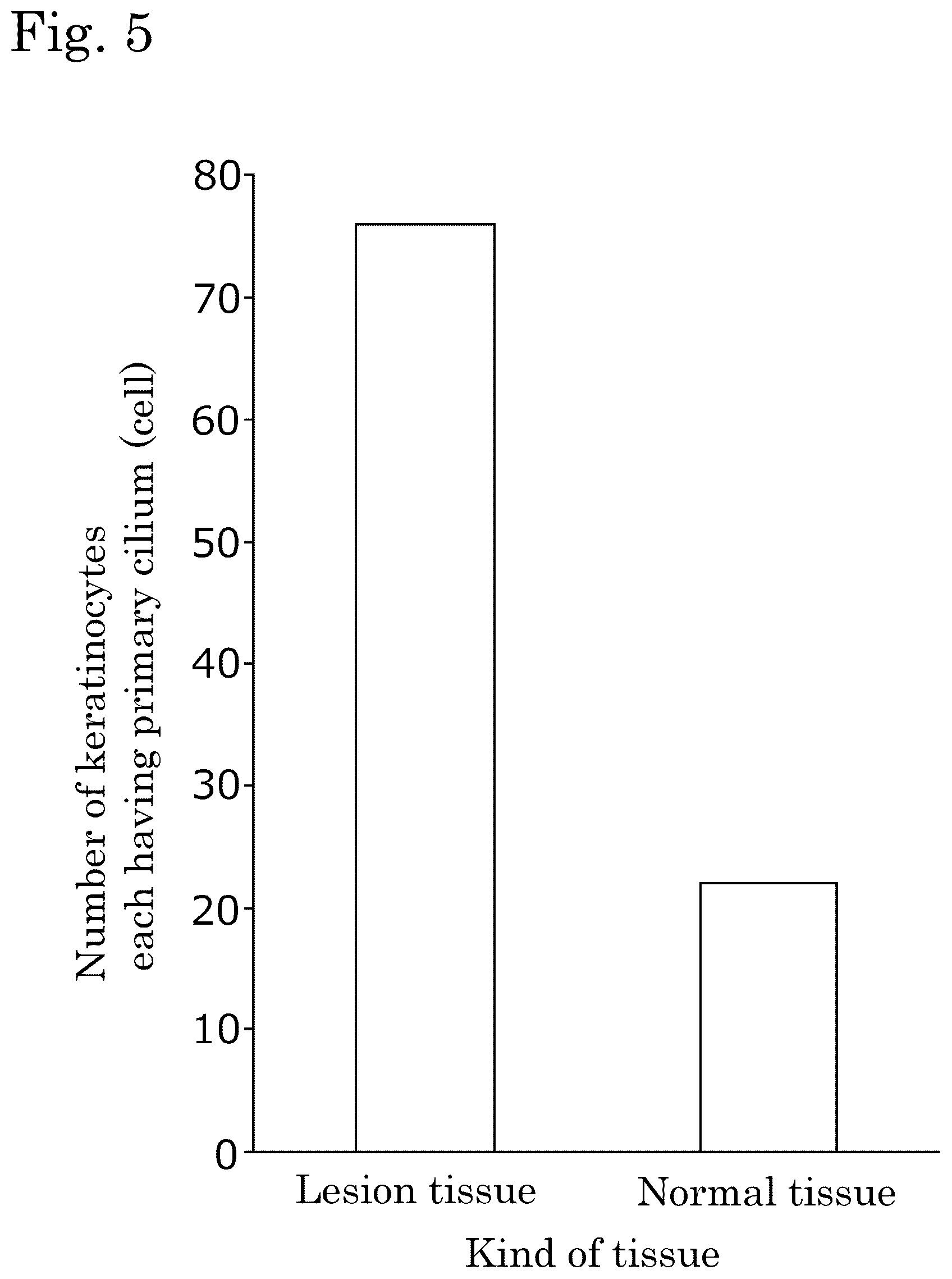 Patent US12306171 Figure 5 – Method for detecting indicator of immune-related disease