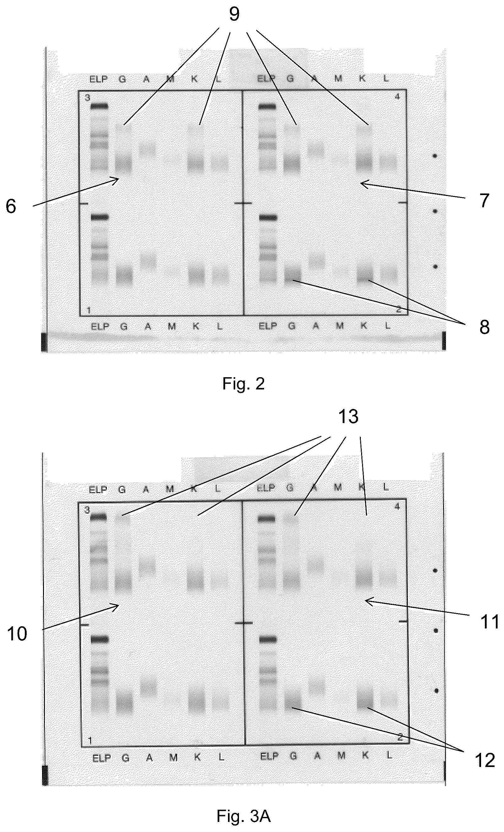 Patent US12306183 Figure 3 – Immunofixation electrophoresis method with target component on-gel immunodisplacement