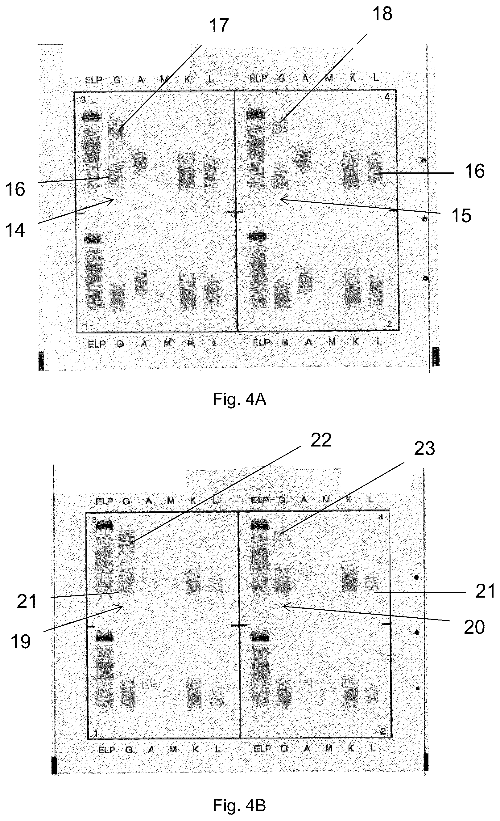 Patent US12306183 Figure 8 – Immunofixation electrophoresis method with target component on-gel immunodisplacement