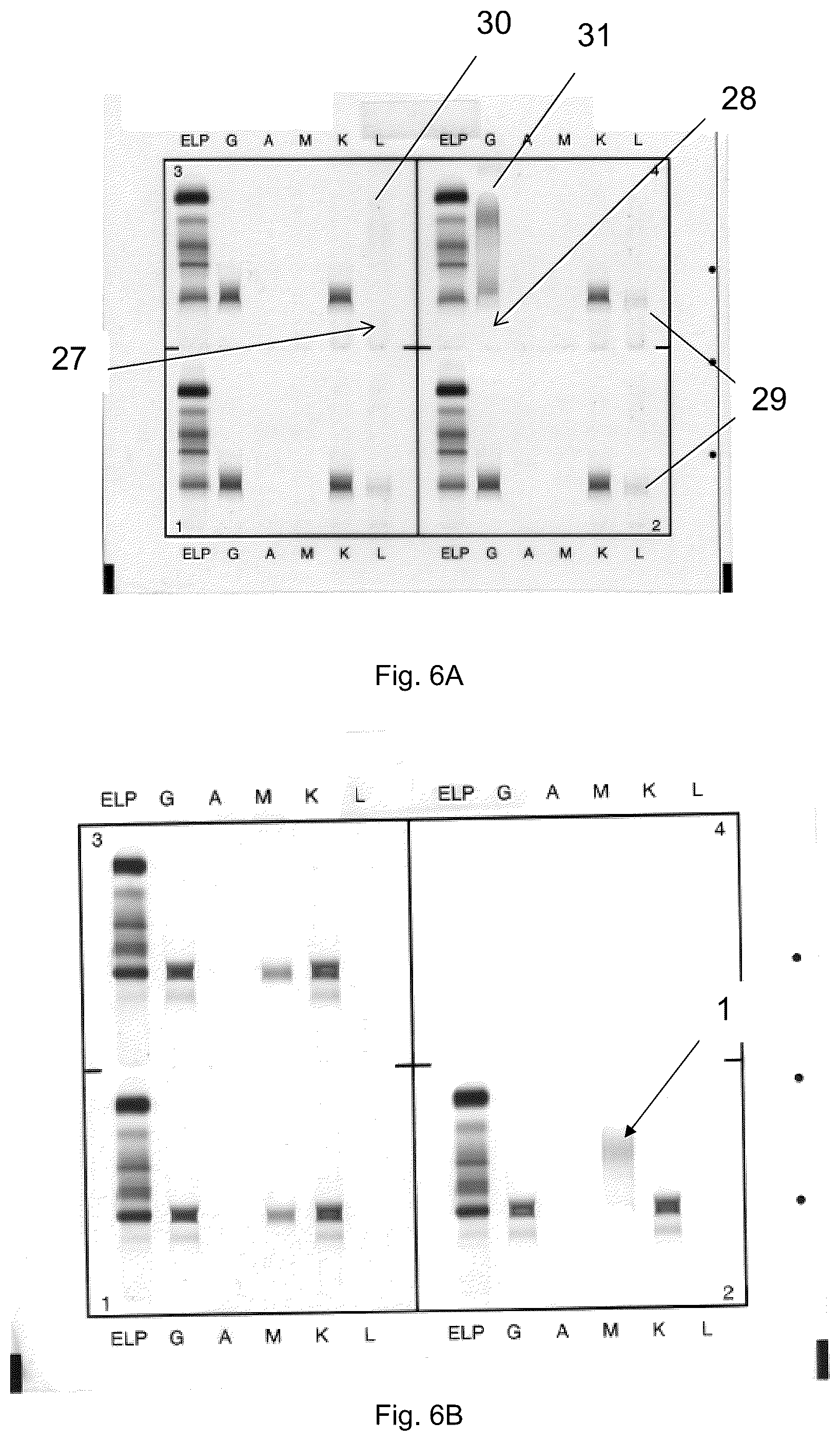 Patent US12306183 Figure 10 – Immunofixation electrophoresis method with target component on-gel immunodisplacement