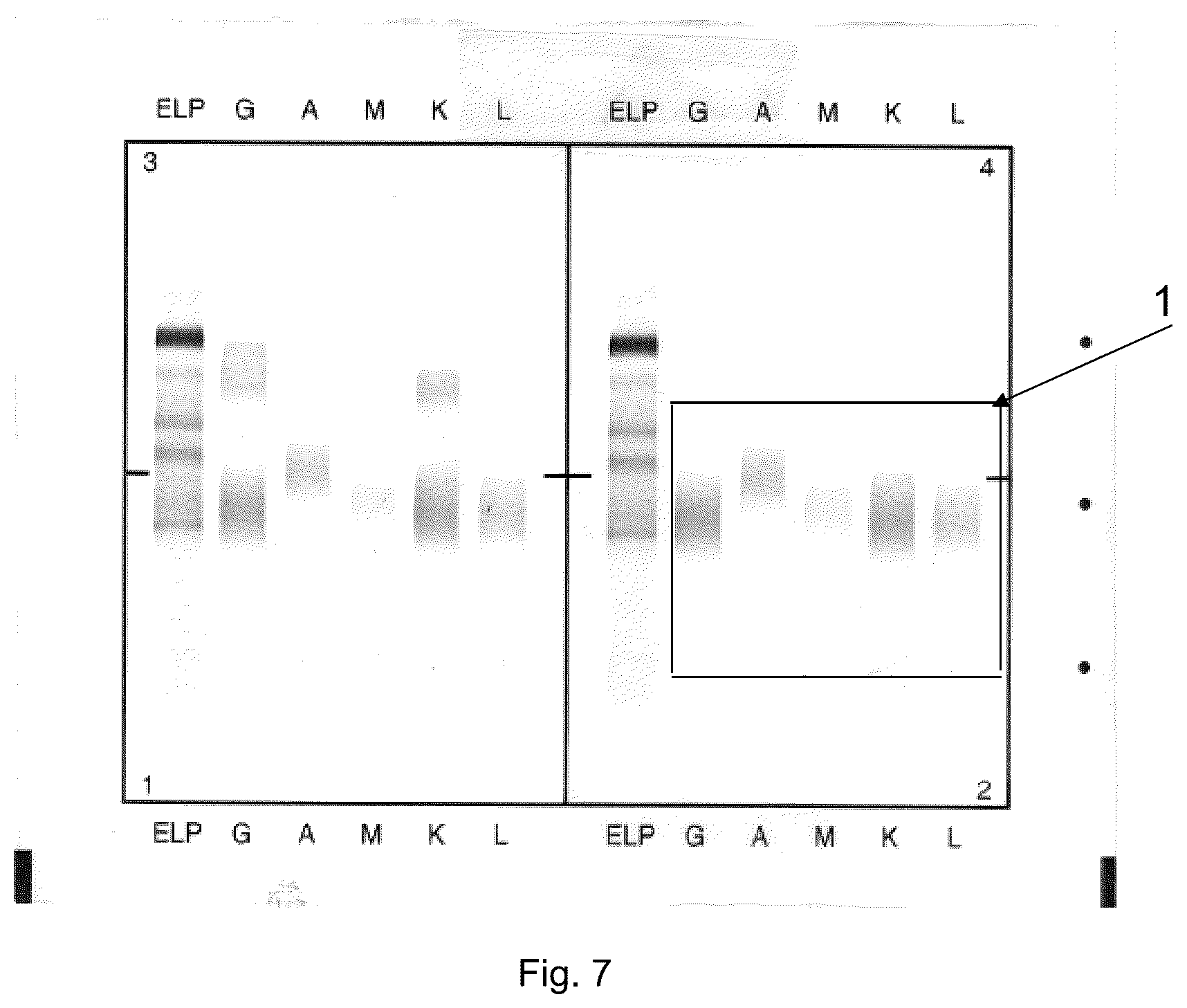 Patent US12306183 Figure 11 – Immunofixation electrophoresis method with target component on-gel immunodisplacement