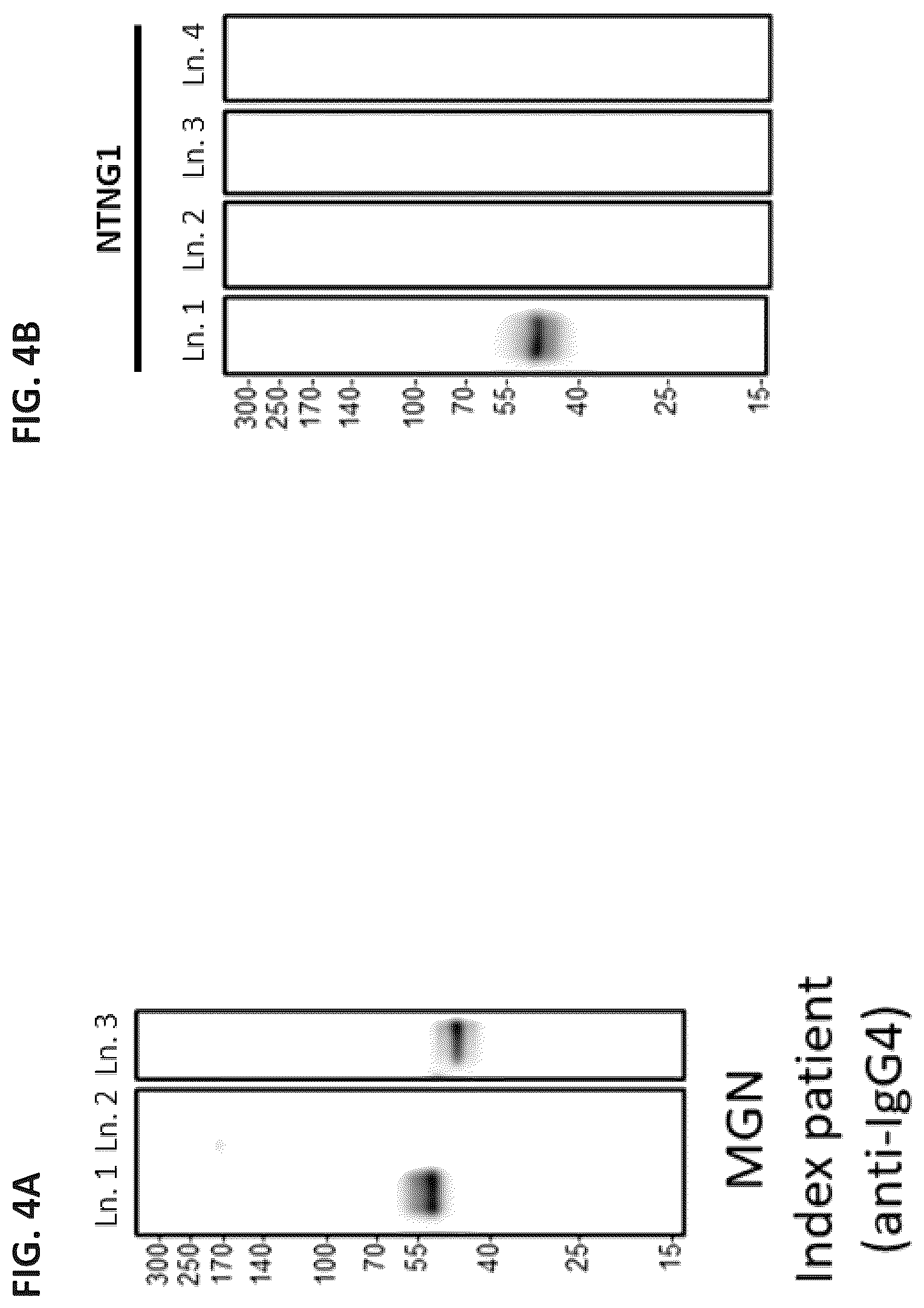 Patent US12306184 Figure 4 – Biomarkers of membranous glomerulonephritis