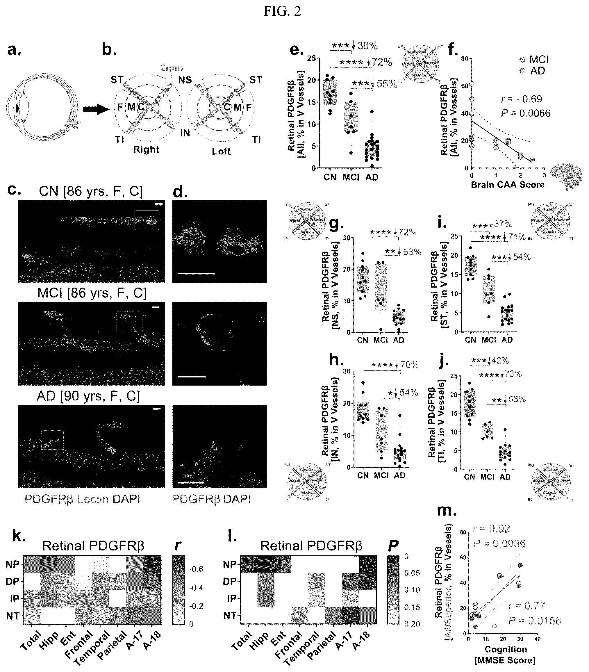 Patent US12306192 Figure 2 – Method of detecting cognitive impairment
