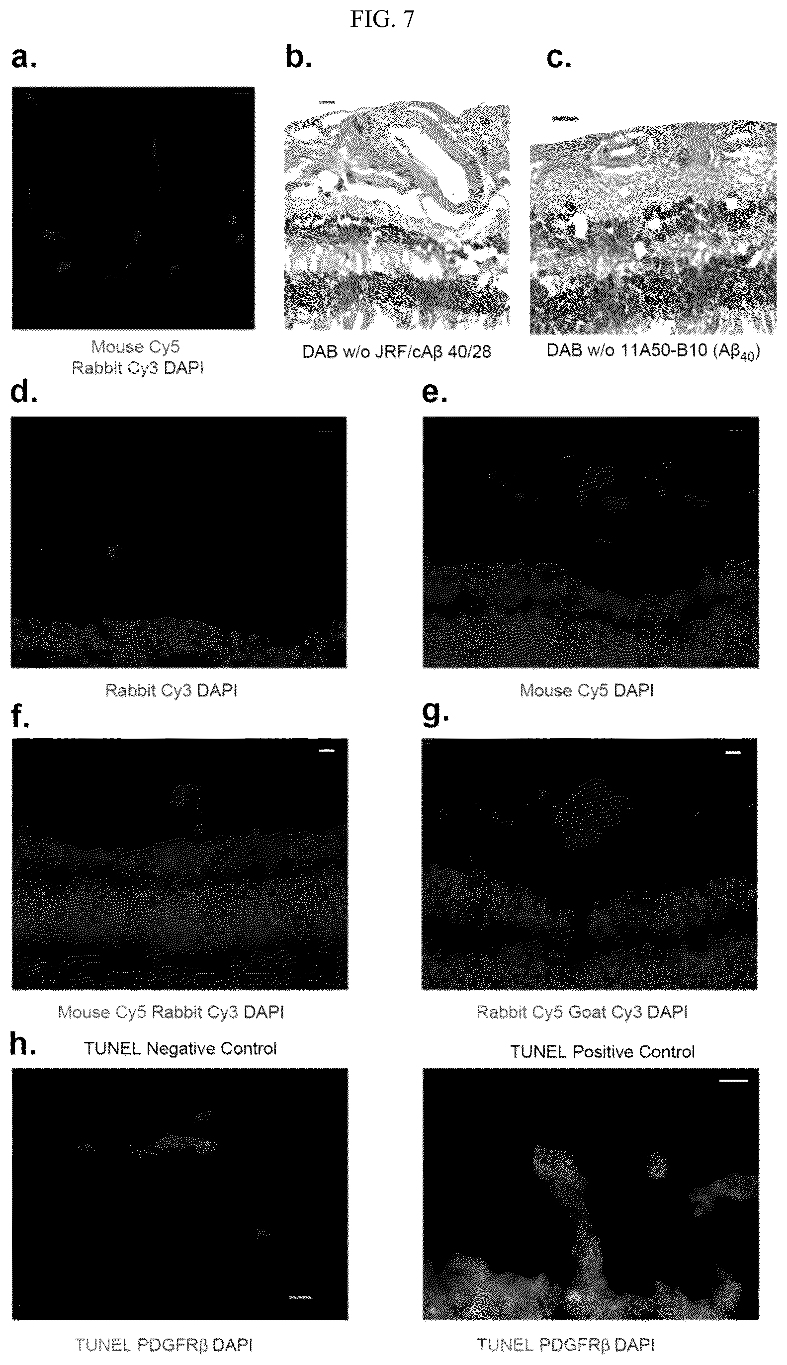 Patent US12306192 Figure 7 – Method of detecting cognitive impairment