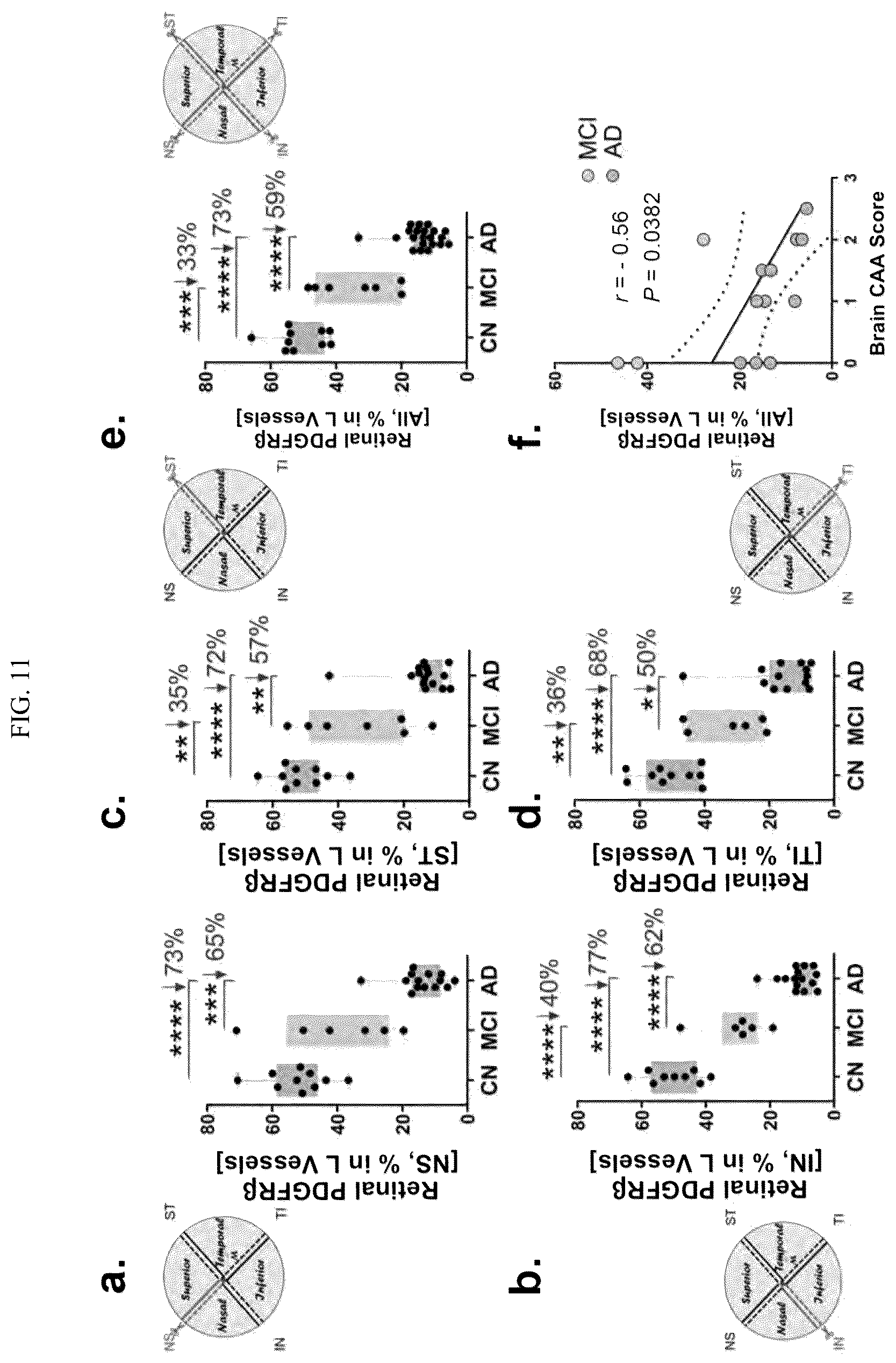 Patent US12306192 Figure 11 – Method of detecting cognitive impairment