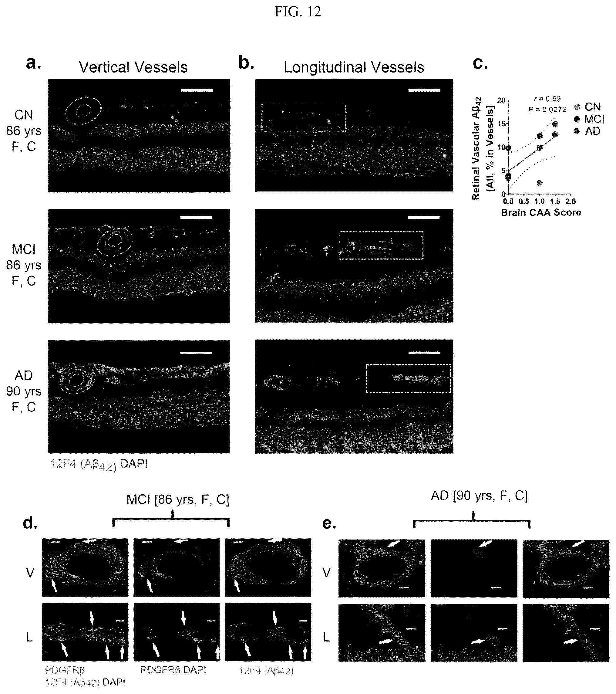 Patent US12306192 Figure 13 – Method of detecting cognitive impairment