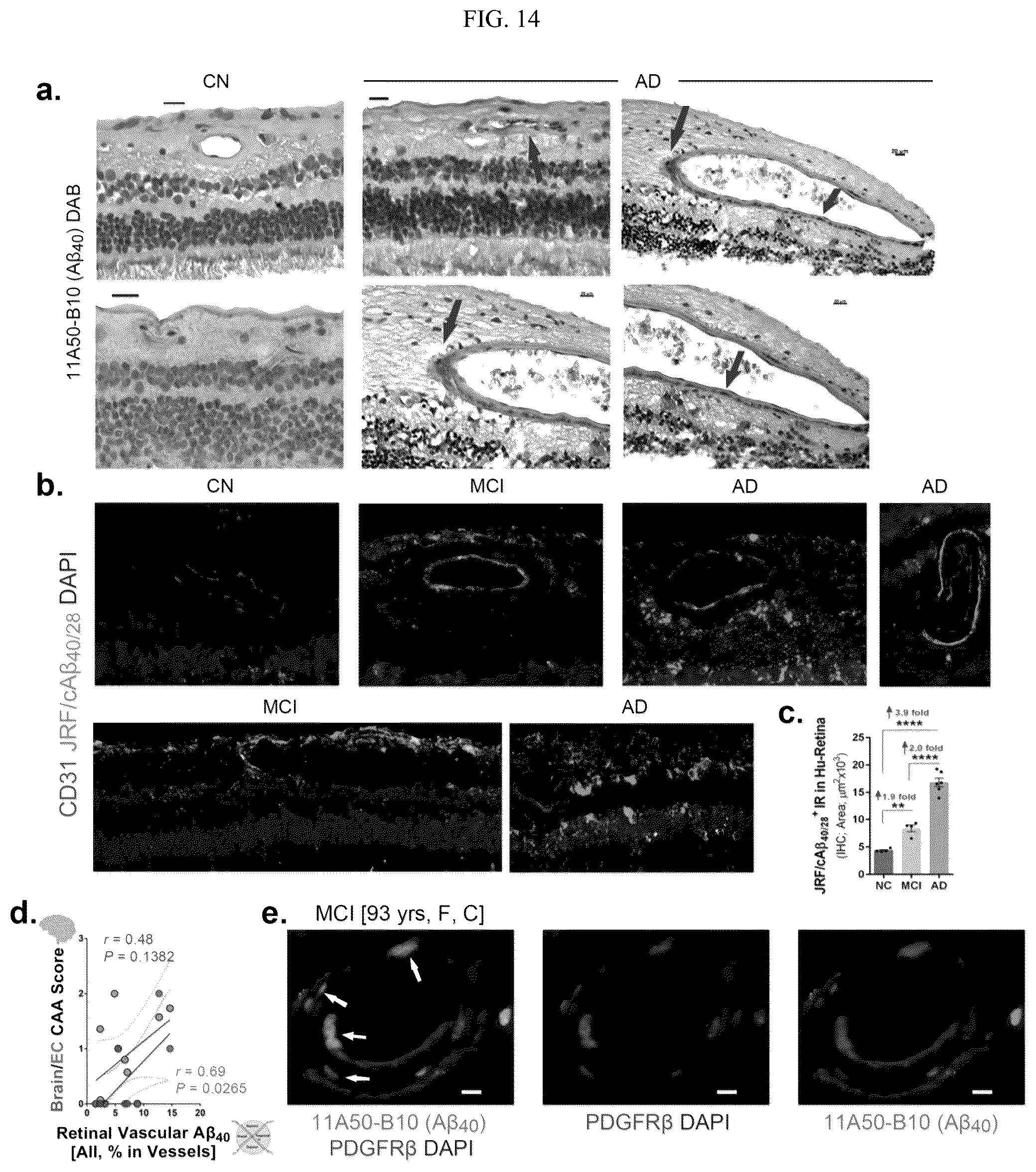 Patent US12306192 Figure 15 – Method of detecting cognitive impairment