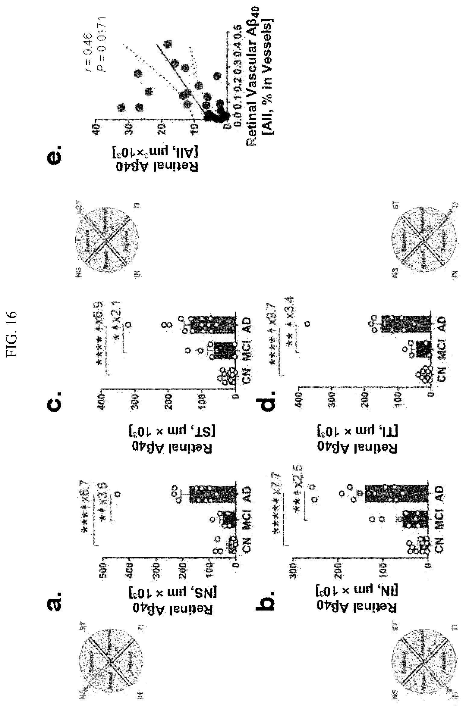 Patent US12306192 Figure 17 – Method of detecting cognitive impairment