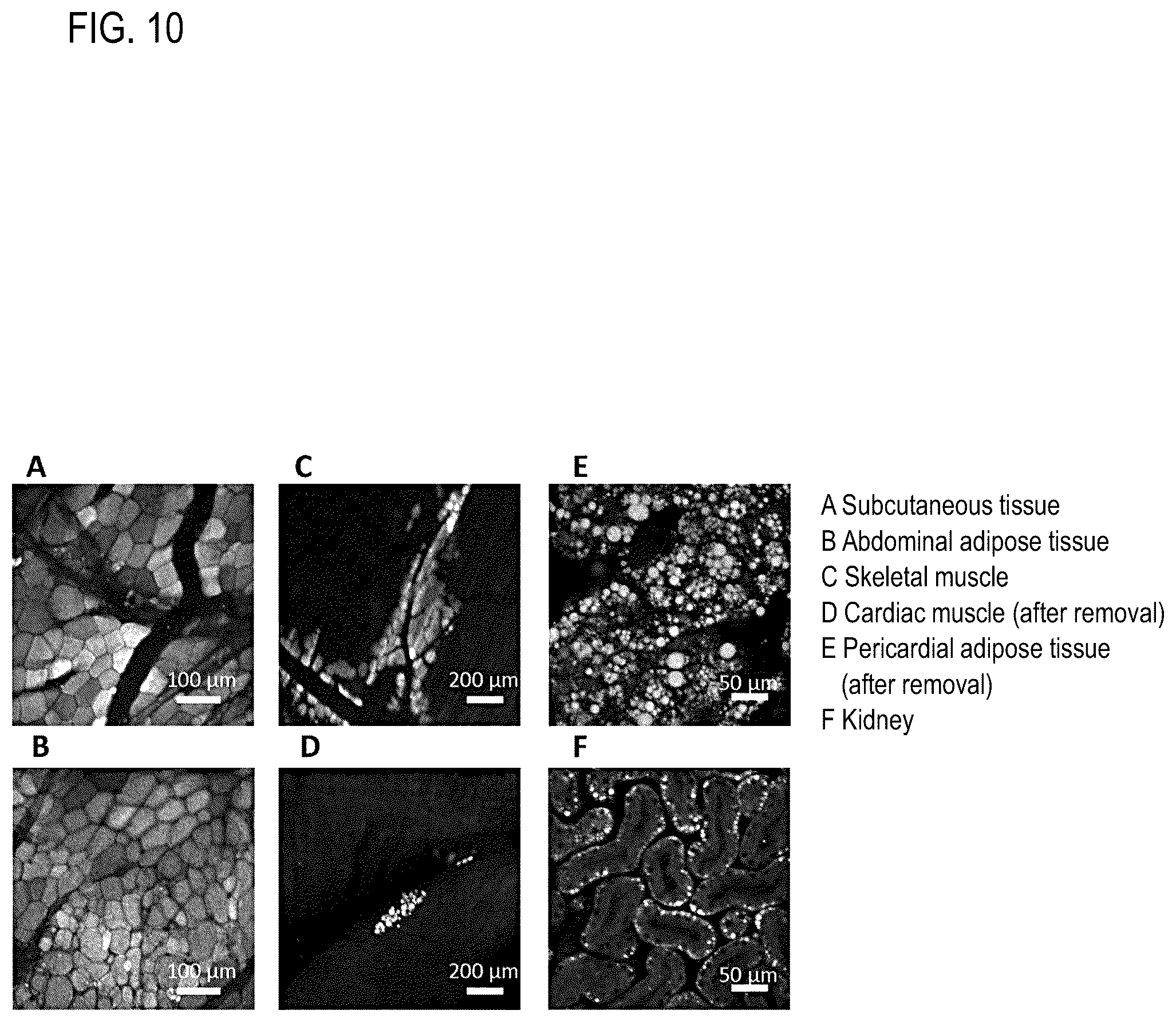 Patent US12306194 Figure 10 – Reagent for fluorescence imaging of lipid droplets in cell and tissue