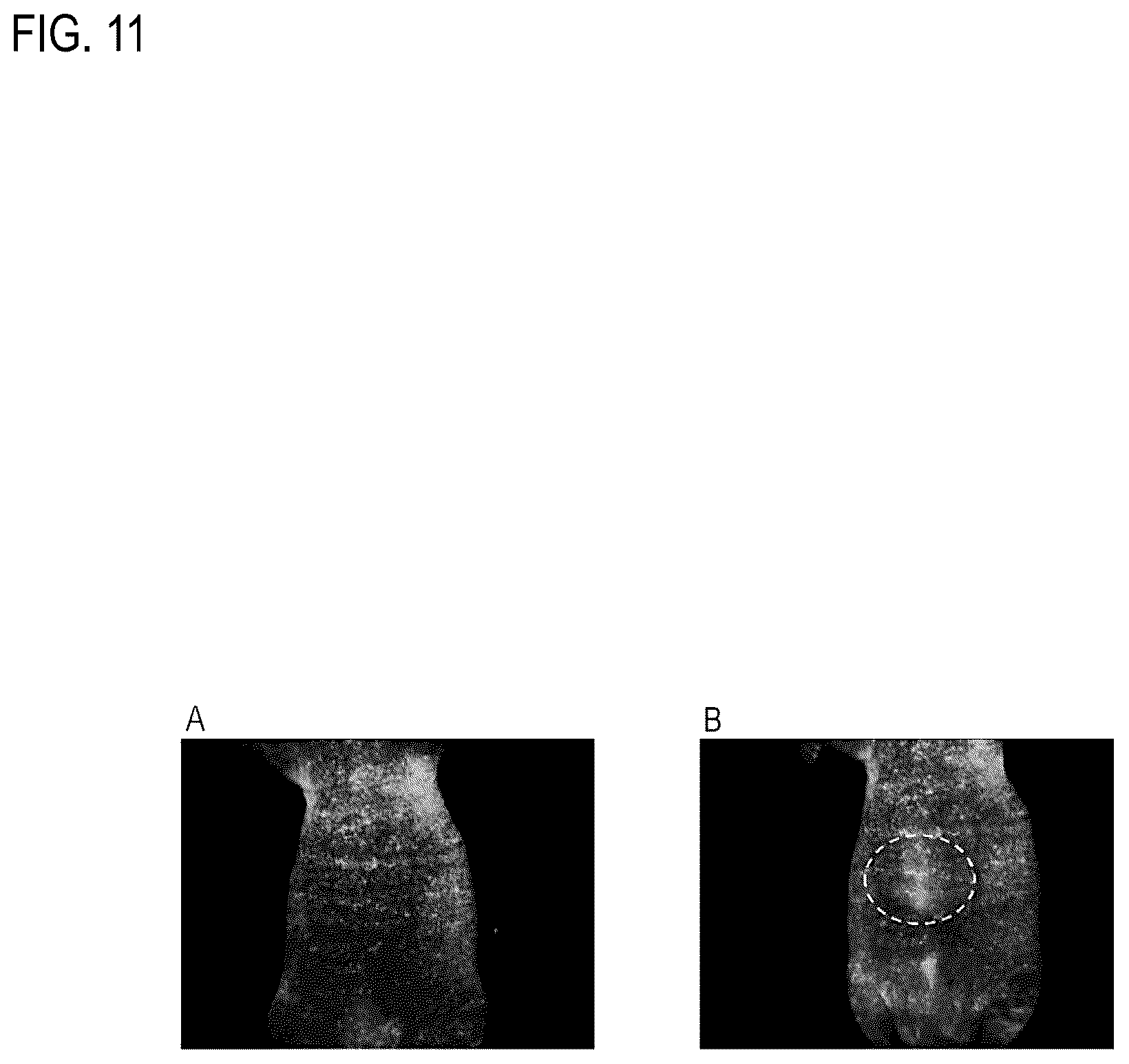 Patent US12306194 Figure 11 – Reagent for fluorescence imaging of lipid droplets in cell and tissue