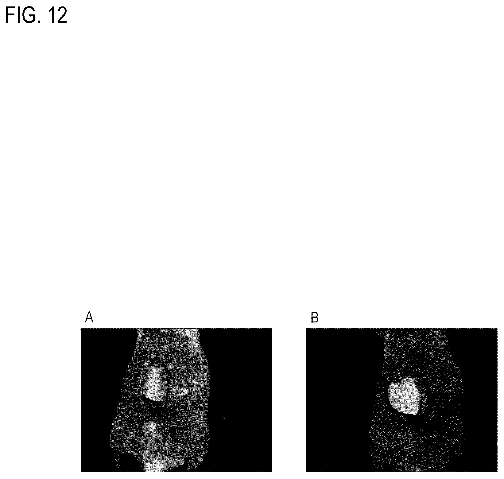 Patent US12306194 Figure 12 – Reagent for fluorescence imaging of lipid droplets in cell and tissue