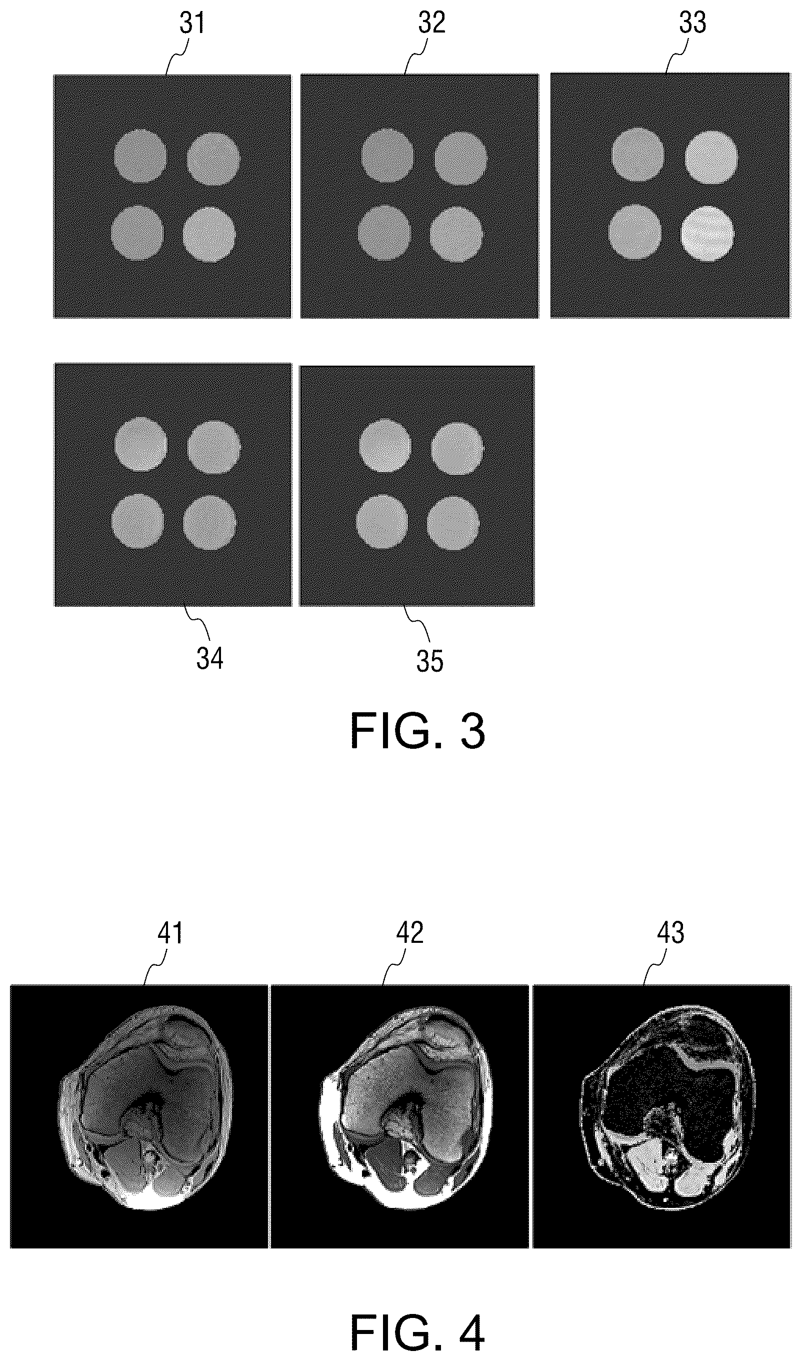 Patent US12306277 Figure 3 – Method and apparatus for quantitative detection of parameters in MRI, and magnetic resonance scanner