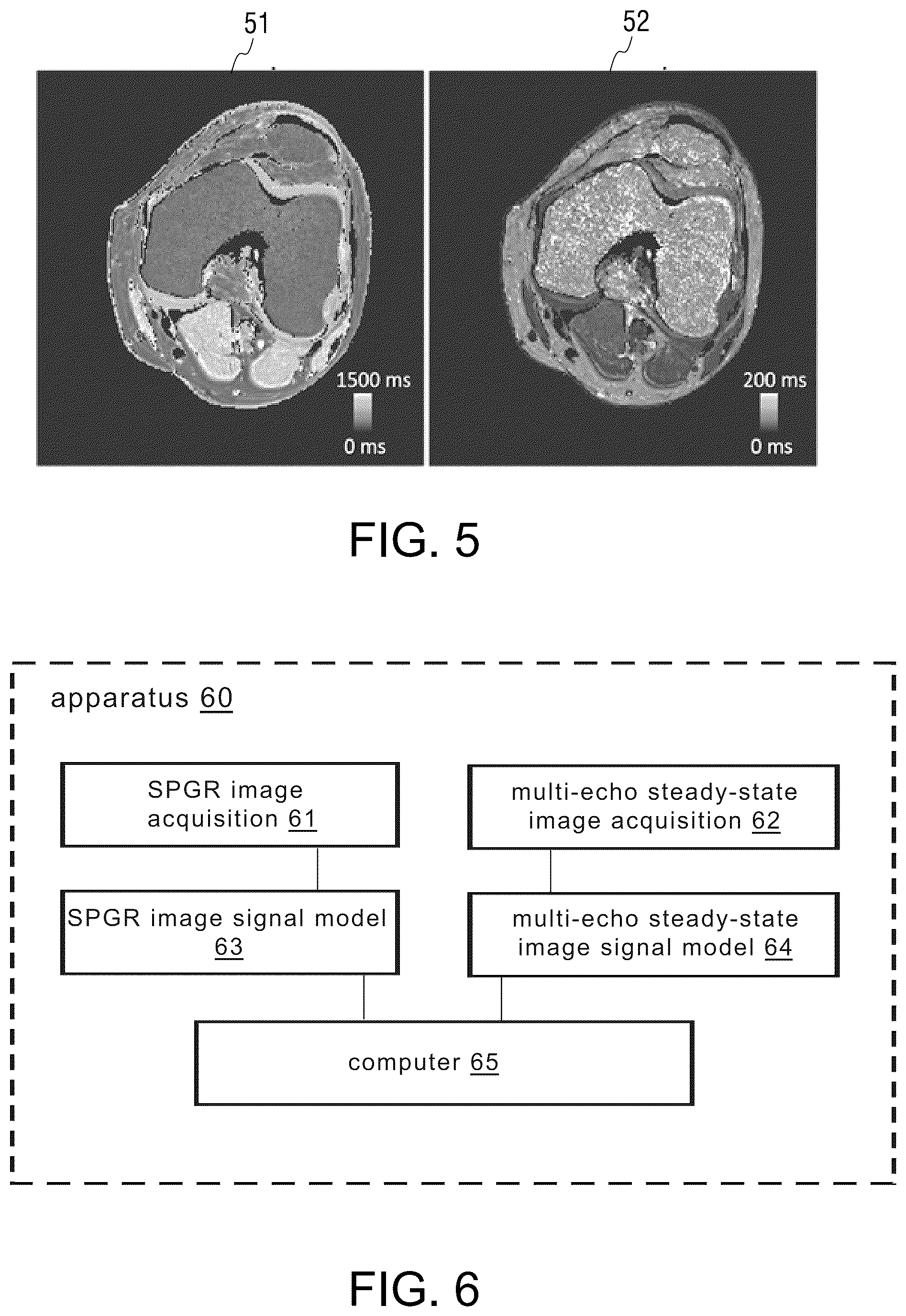 Patent US12306277 Figure 4 – Method and apparatus for quantitative detection of parameters in MRI, and magnetic resonance scanner
