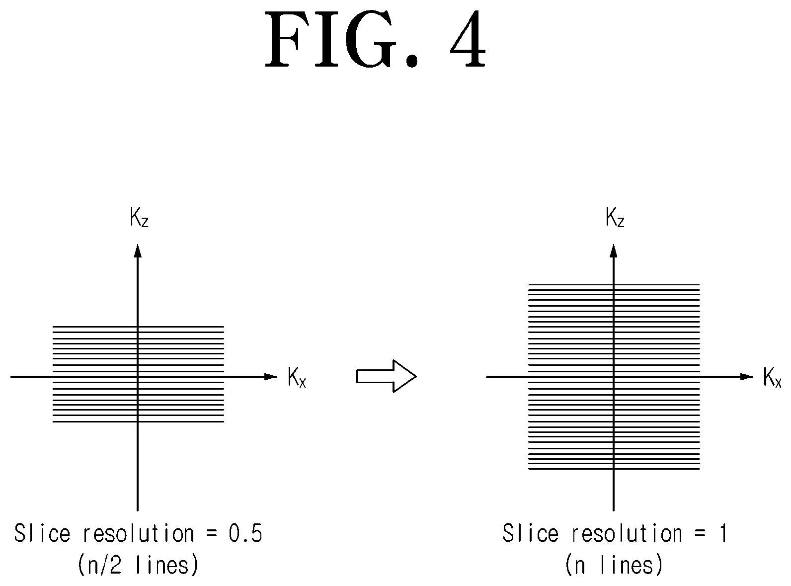Patent US12306278 Figure 4 – Magnetic resonance image processing apparatus and method to which improvement in slice resolution is applied