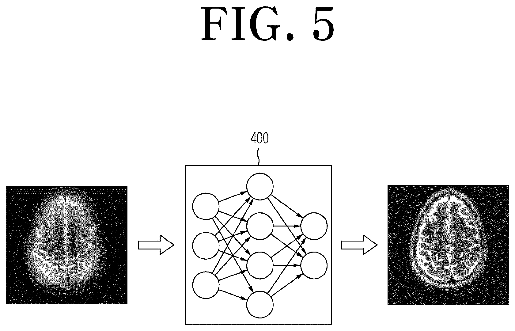 Patent US12306278 Figure 5 – Magnetic resonance image processing apparatus and method to which improvement in slice resolution is applied