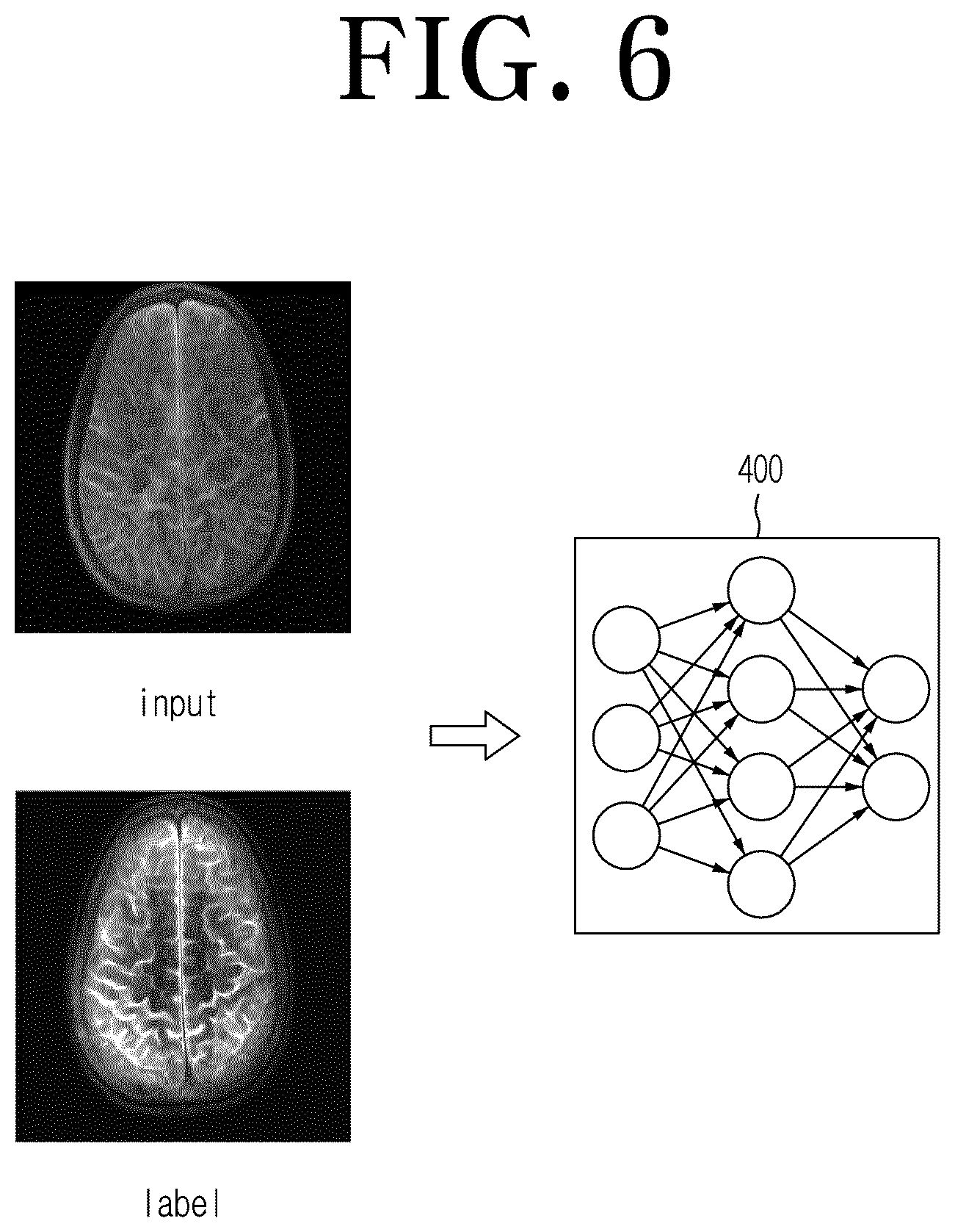 Patent US12306278 Figure 6 – Magnetic resonance image processing apparatus and method to which improvement in slice resolution is applied
