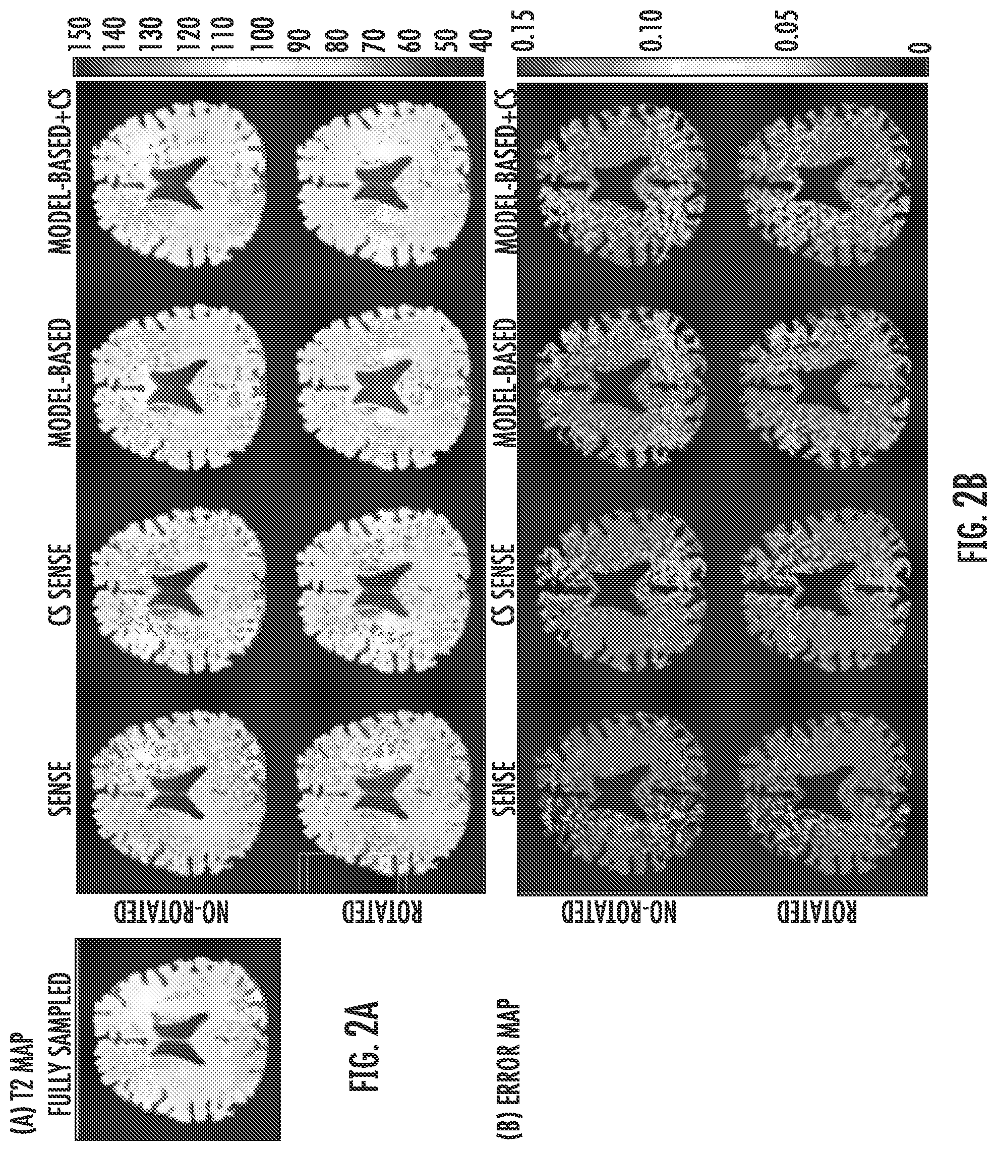 Patent US12306279 Figure 2 – Quantitative mapping of MRI relaxation parameters