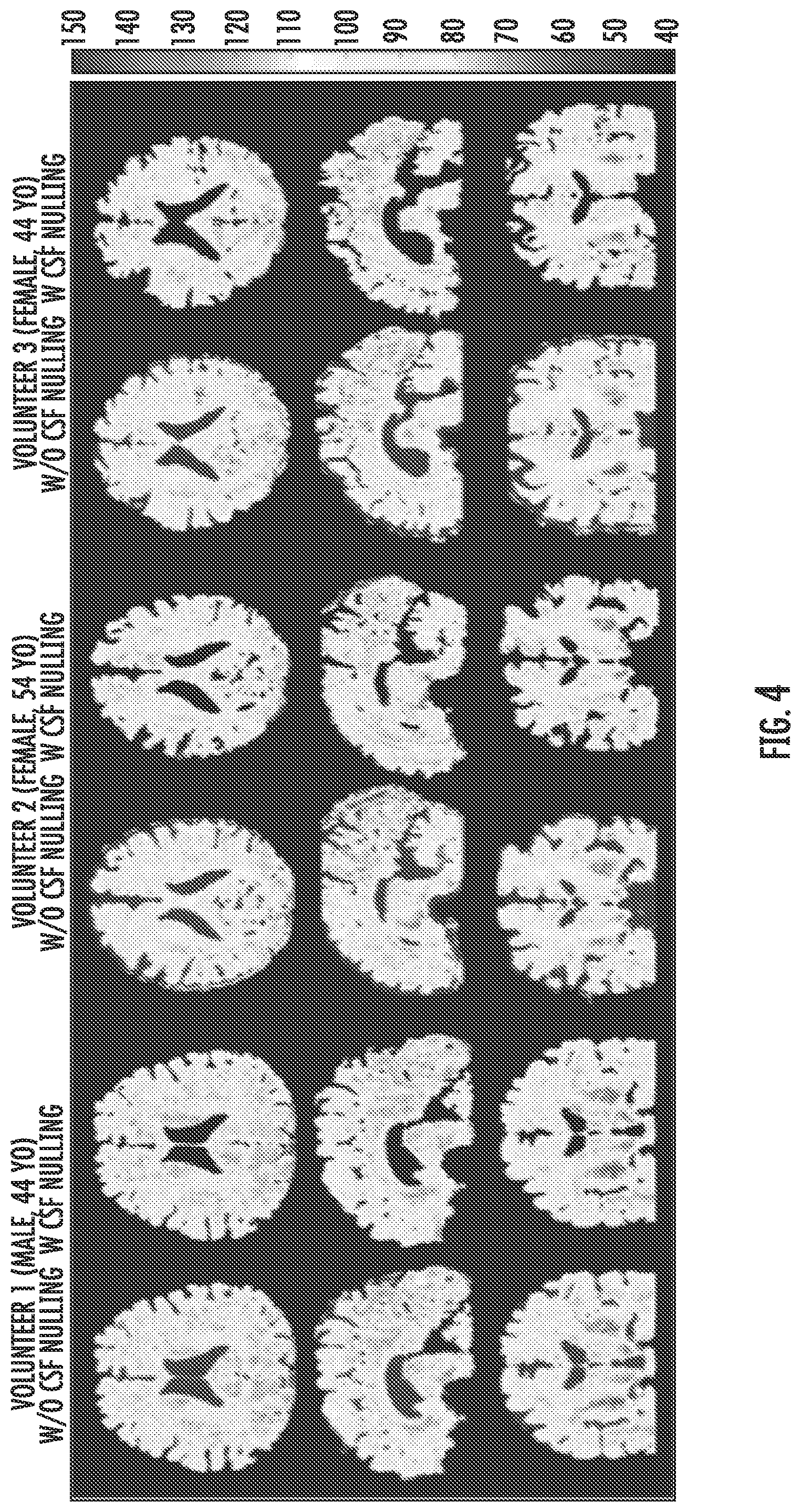 Patent US12306279 Figure 4 – Quantitative mapping of MRI relaxation parameters