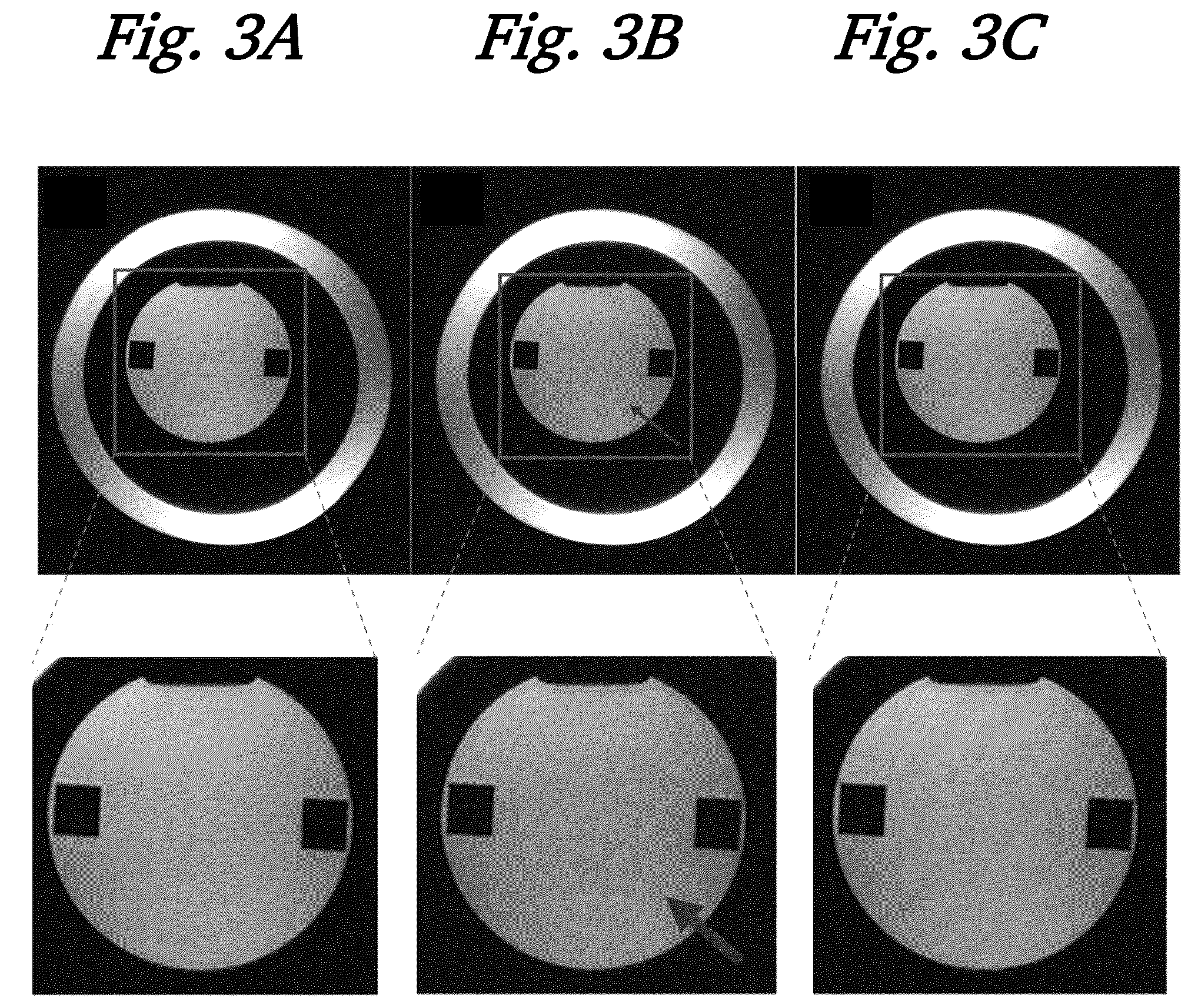 Patent US12306280 Figure 3 – Magnetic resonance imaging using 3D spoiled gradient-recalled sequence