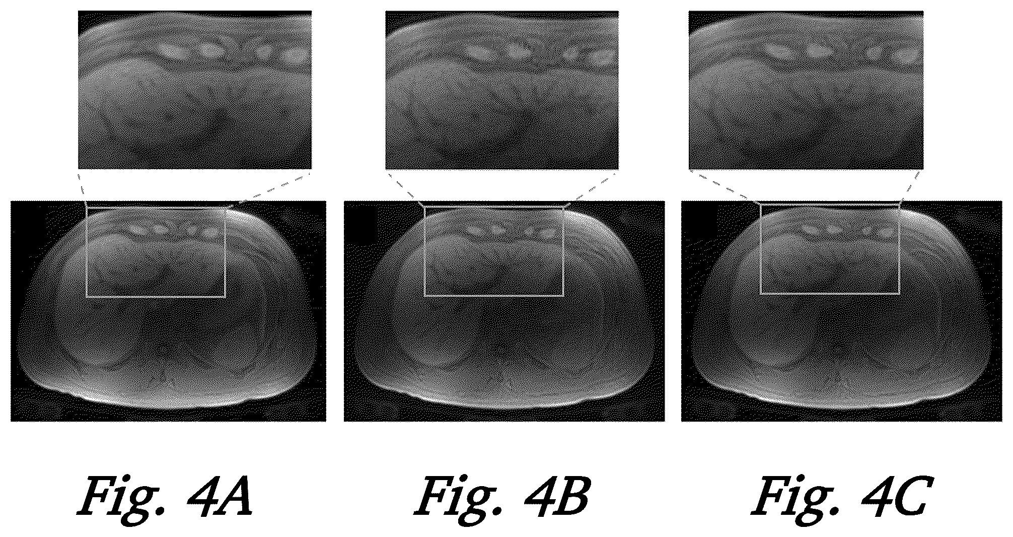 Patent US12306280 Figure 4 – Magnetic resonance imaging using 3D spoiled gradient-recalled sequence