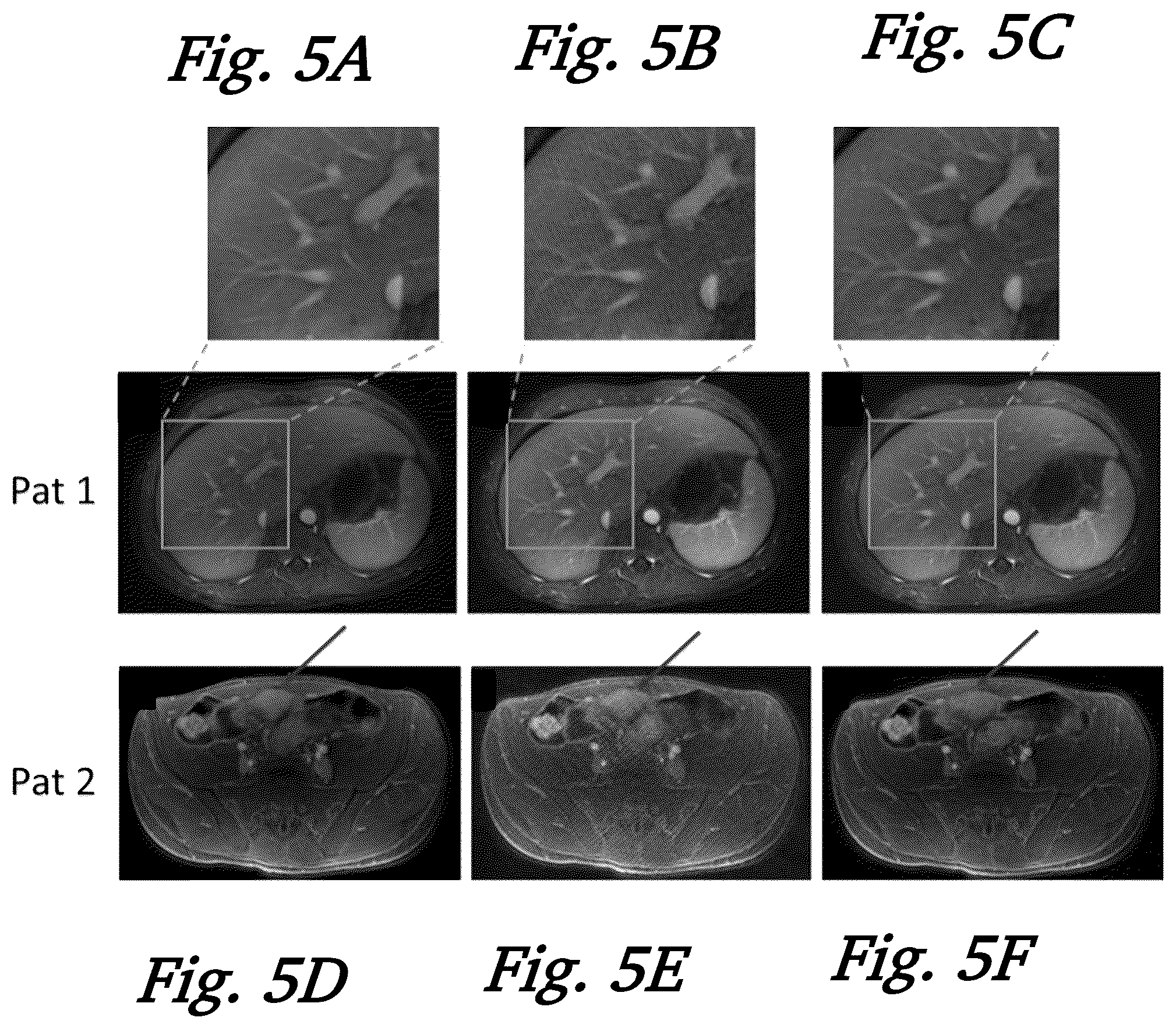 Patent US12306280 Figure 5 – Magnetic resonance imaging using 3D spoiled gradient-recalled sequence