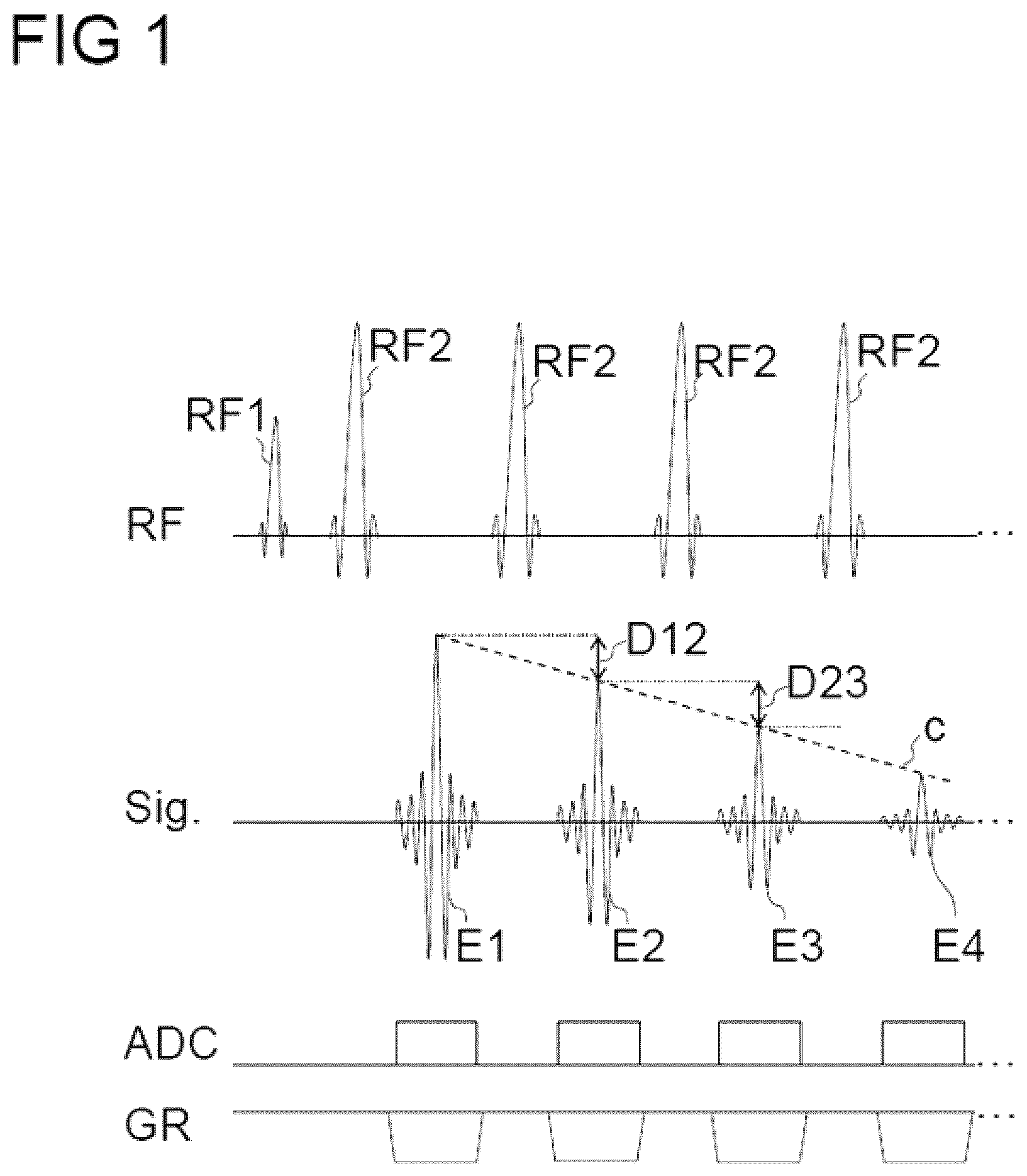 Patent US12306282 Figure 1 – Avoiding artifacts in image data reconstructed from measurement data acquired by means of a turbo spin echo sequence