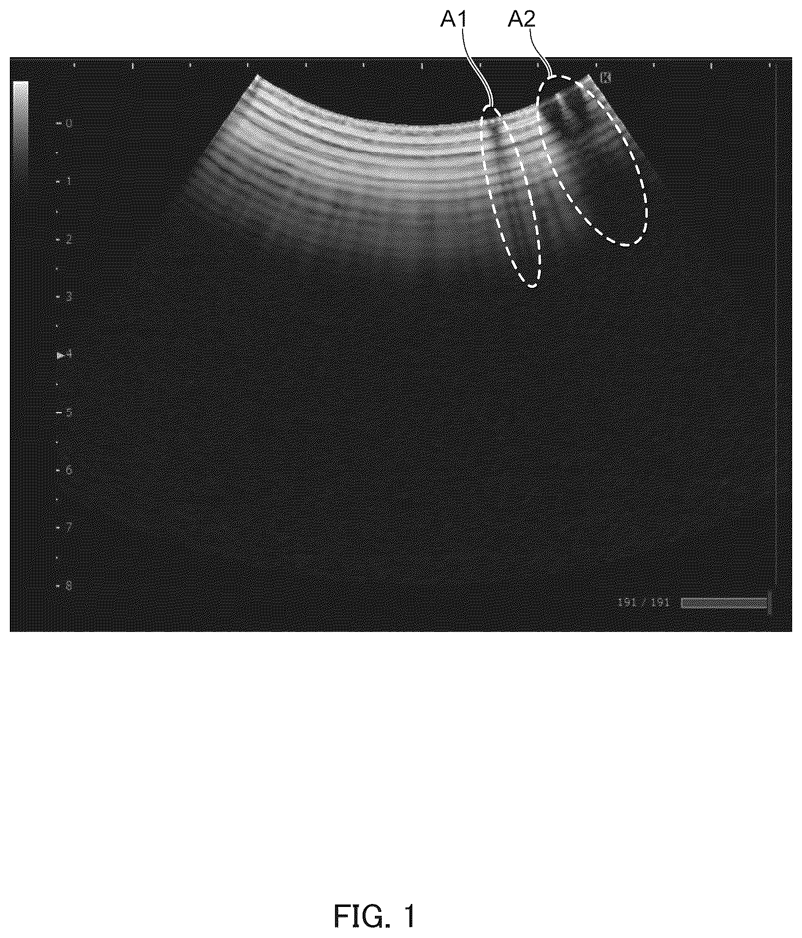 Patent US12306352 Figure 1 – Ultrasound diagnostic apparatus, method of controlling ultrasound diagnostic apparatus, and non-transitory computer-readable recording medium storing therein computer-readable program for controlling ultrasound diagnostic apparatus