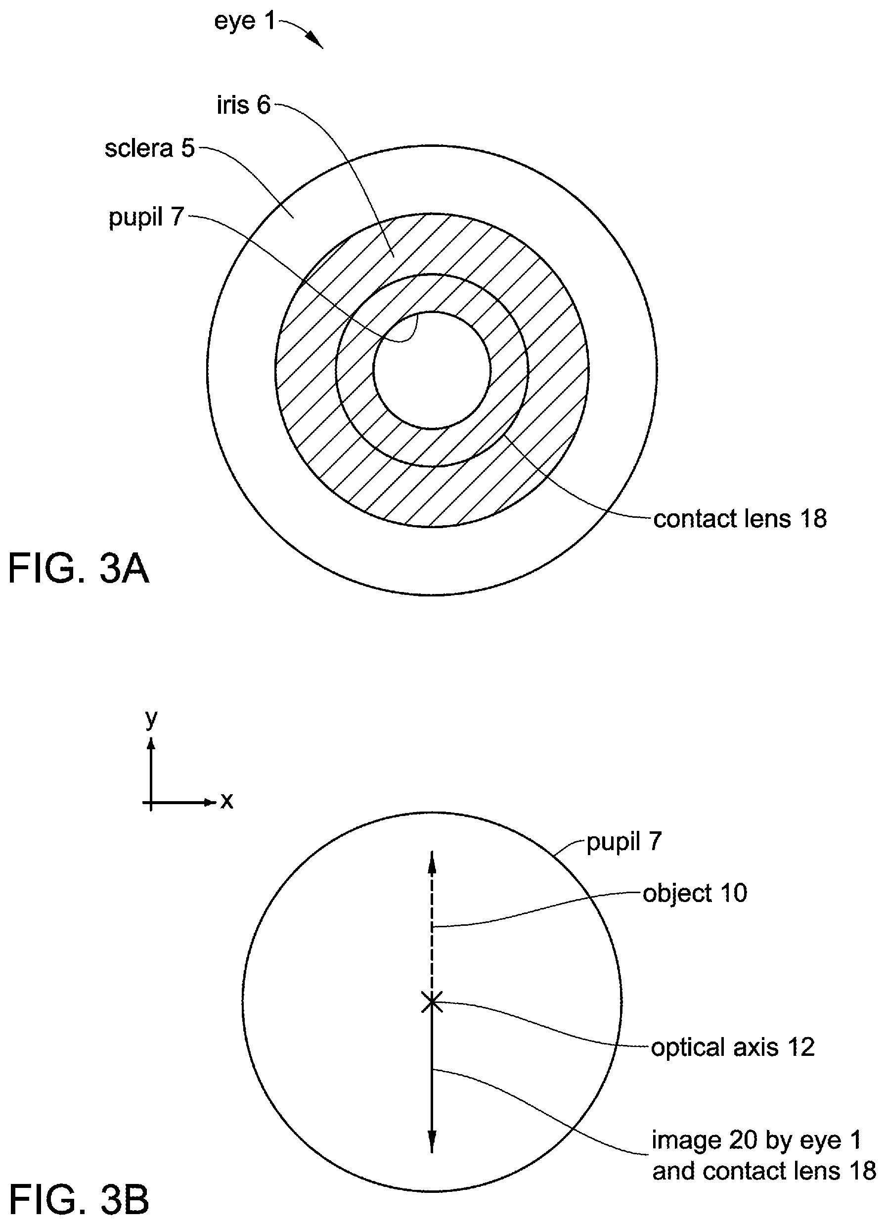Patent US12306471 Figure 3 – Prismatic contact lens