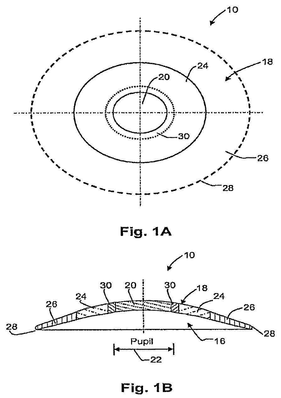 Patent US12306473 Figure 1 – Means for controlling the progression of myopia